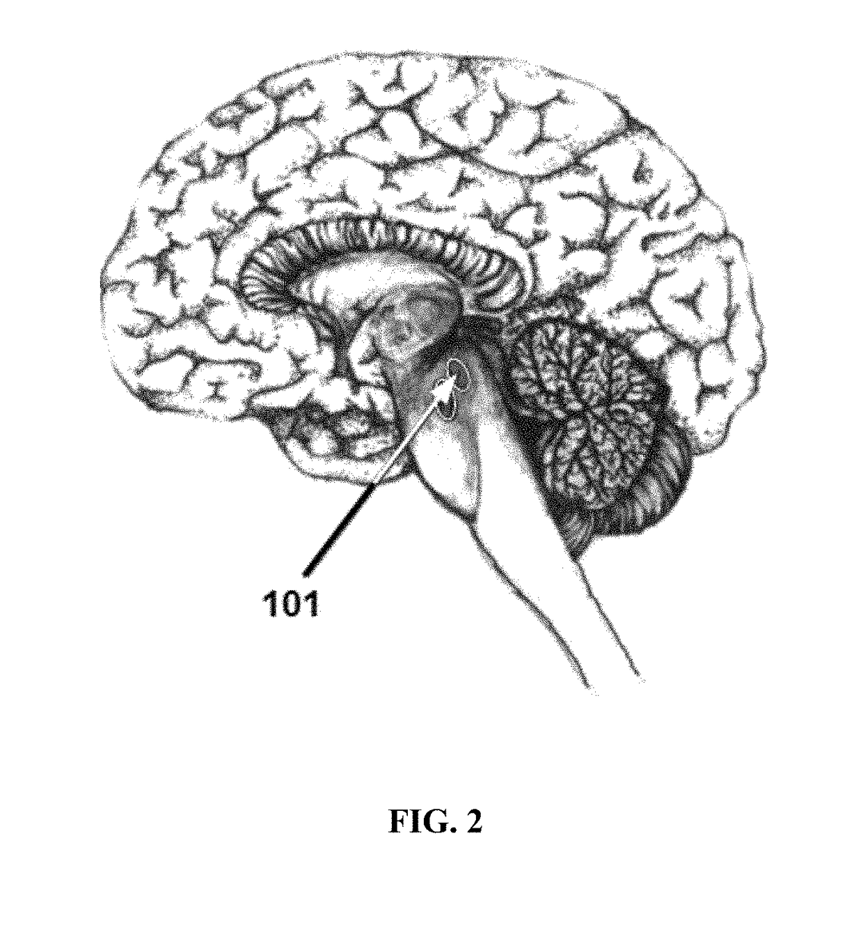 Method for treating parkinson disease, neurodegenerative disorders, and autoimmune diseases