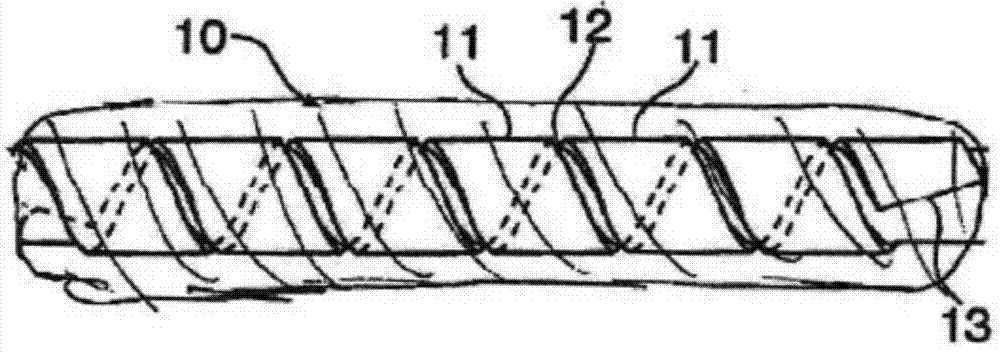 Spiral Hybrid Stent