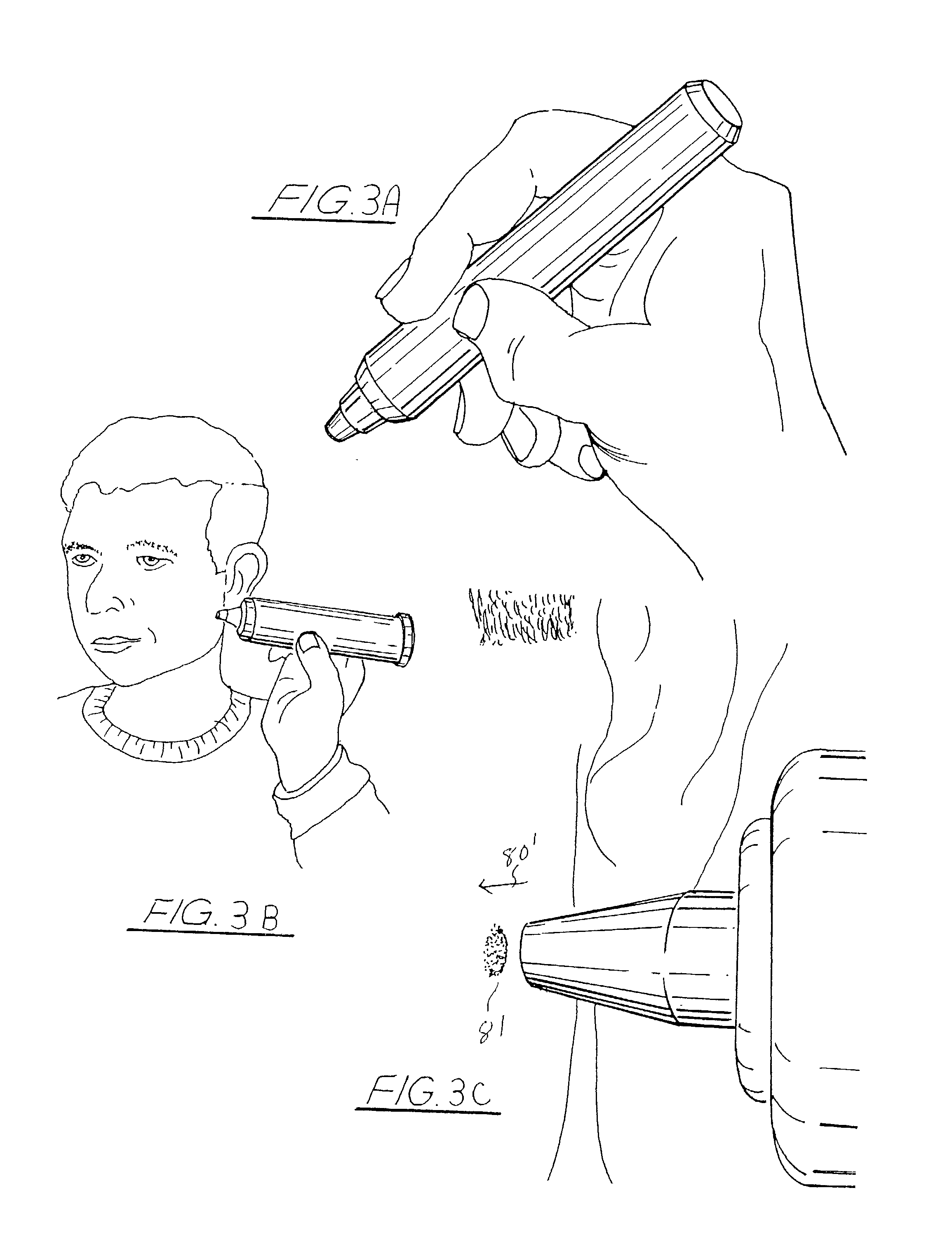 Hand-held, heat sink cryoprobe, system for heat extraction thereof, and method therefore