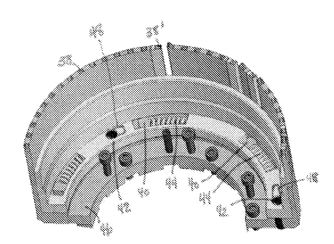 Methods for twisting rotor and stator ends