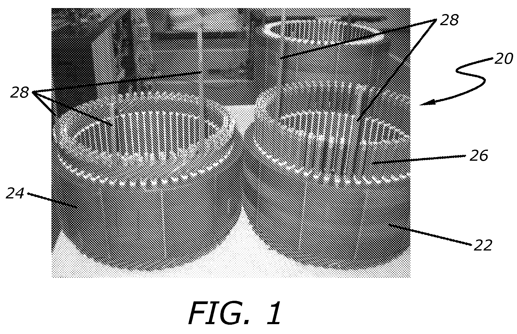 Methods for twisting rotor and stator ends