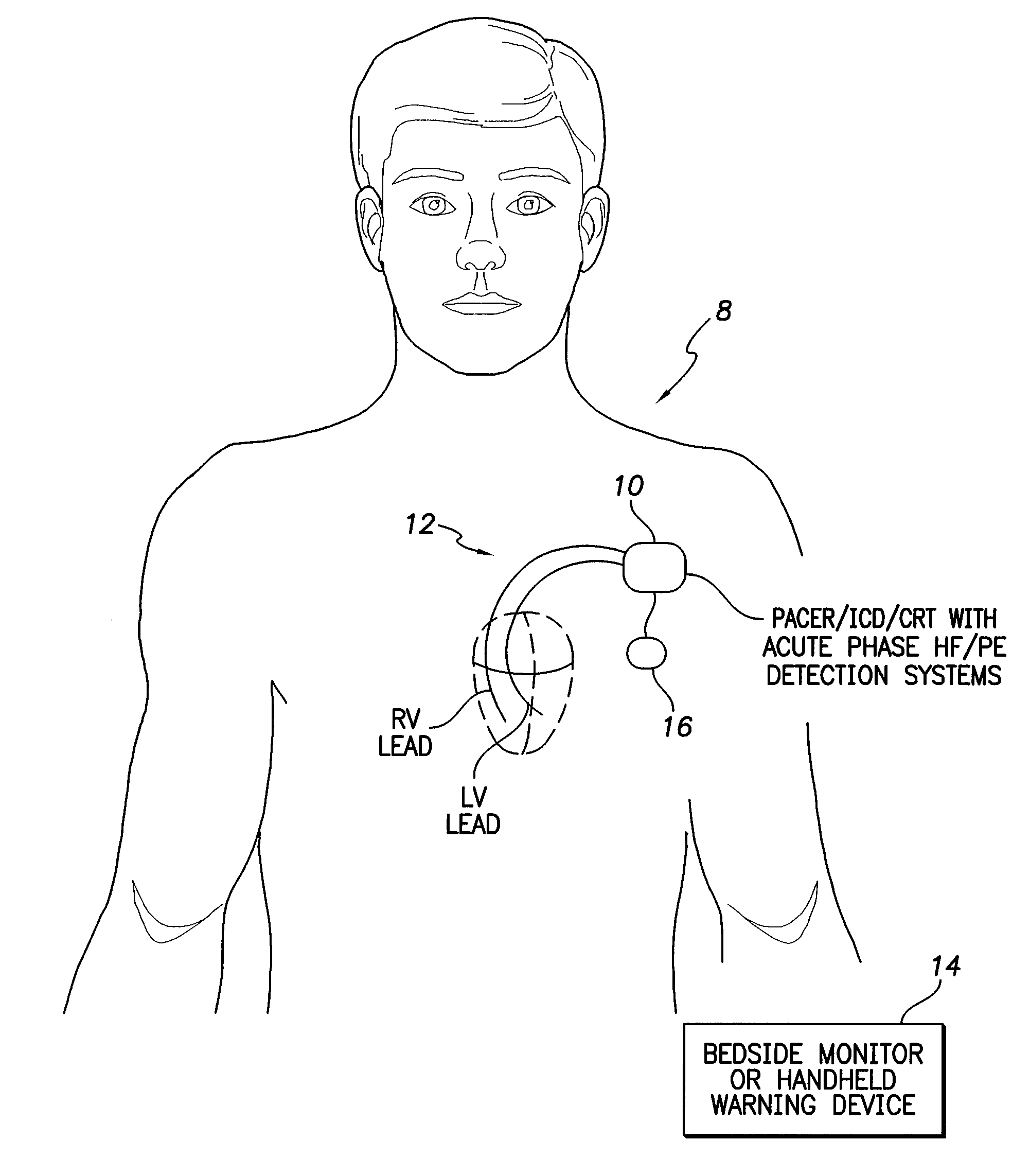 Systems and methods for activating and controlling impedance-based detection systems of implantable medical devices