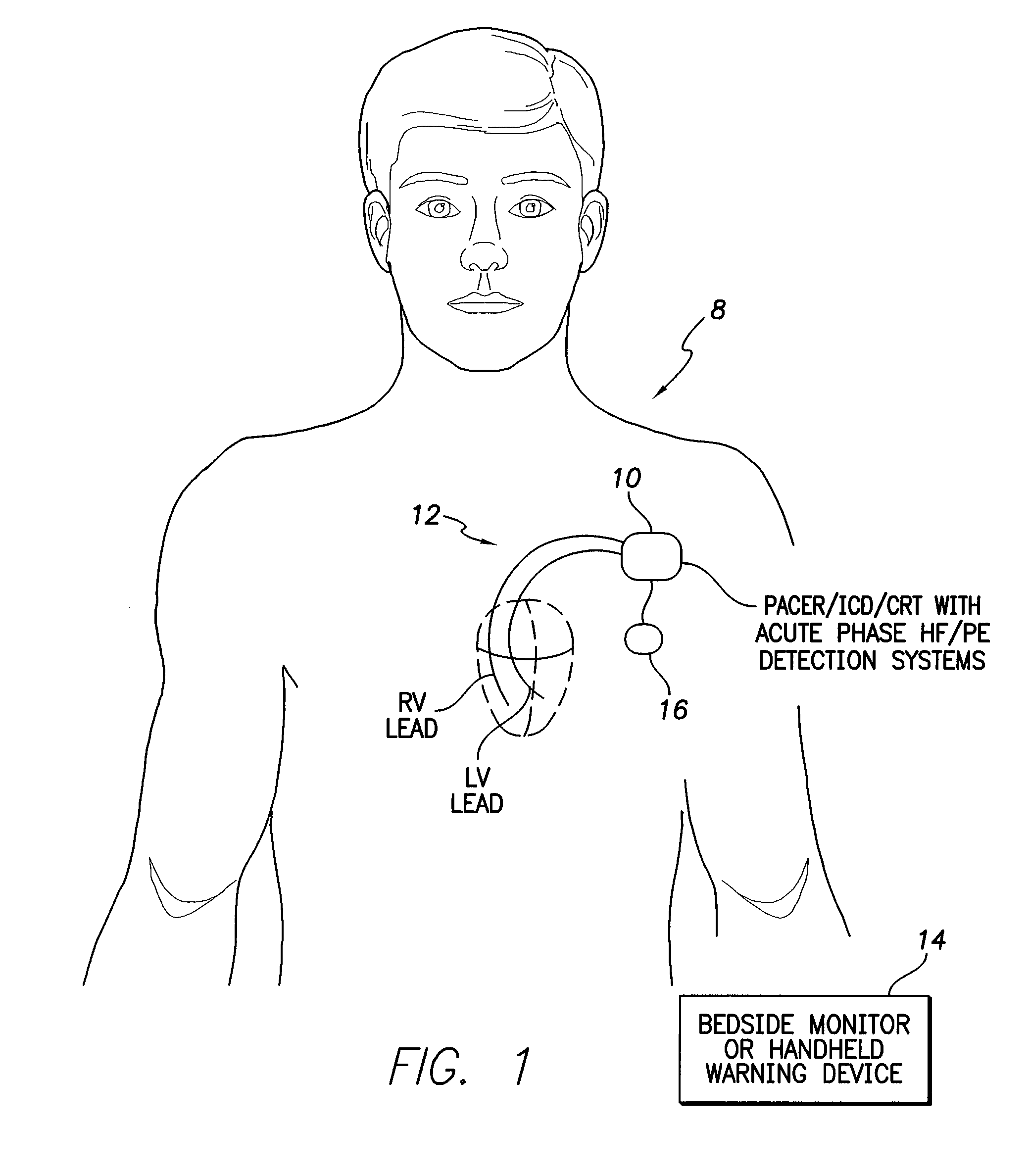 Systems and methods for activating and controlling impedance-based detection systems of implantable medical devices