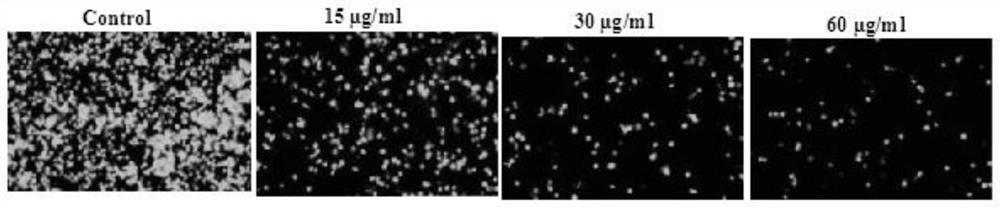 Application of Yiqing compound preparation to preparation of drugs for preventing/treating novel coronavirus infection