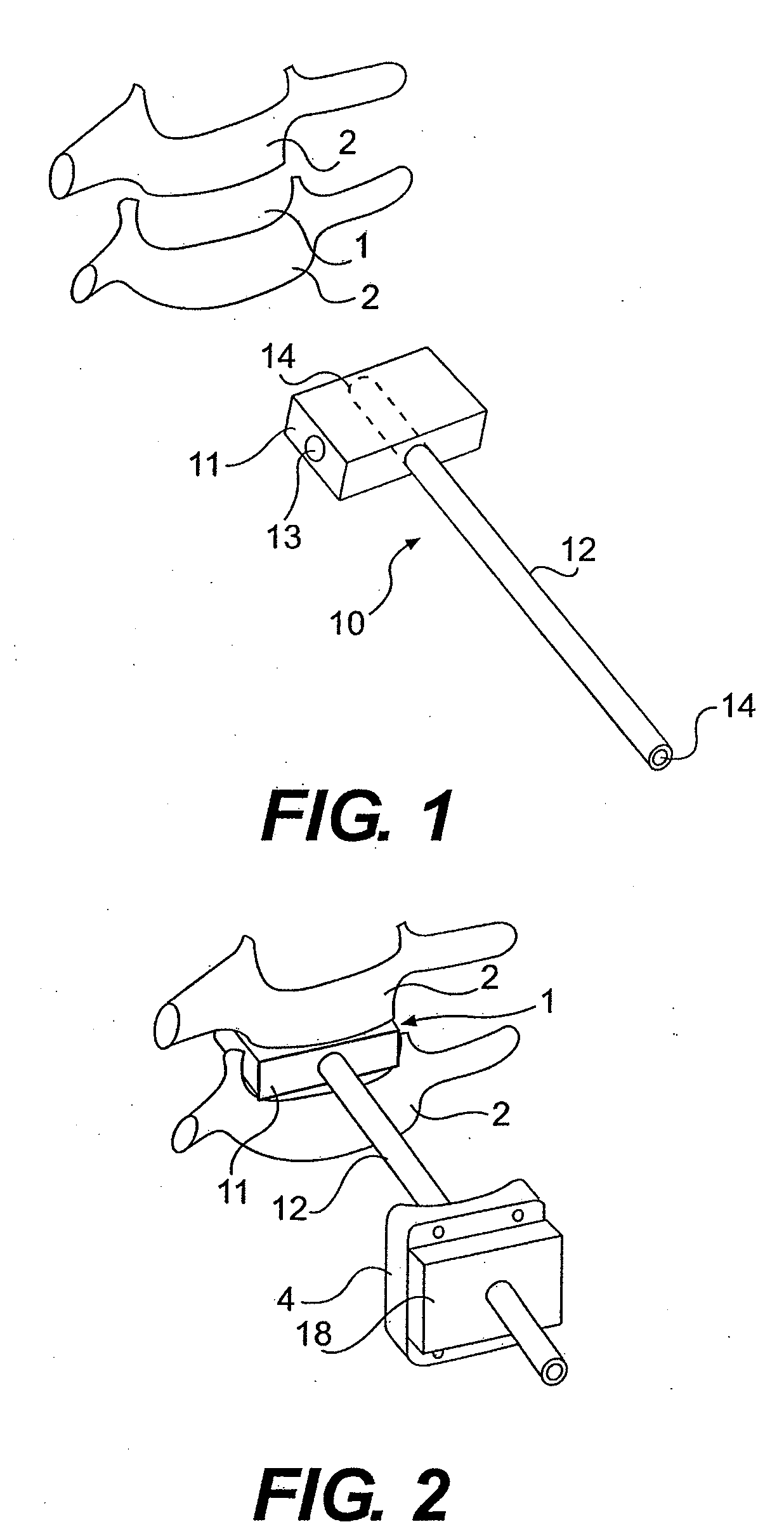 Instrument set for fitting an intervertebral jont prosthesis