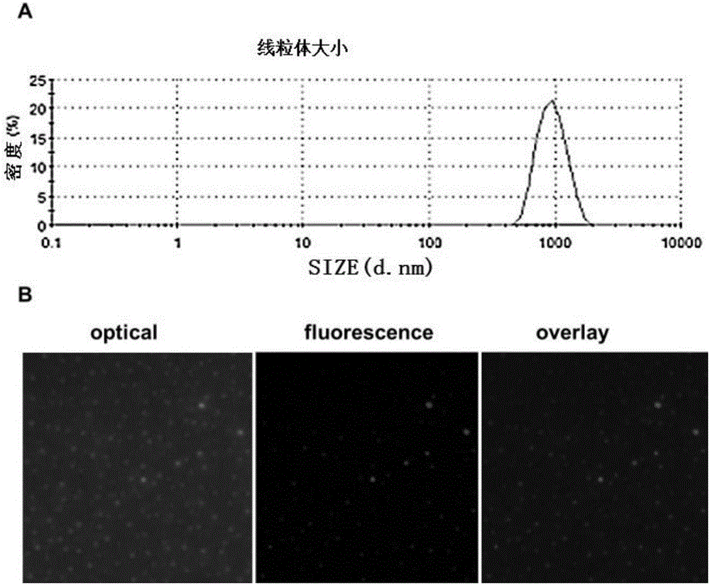 Mitochondria injection and application thereof