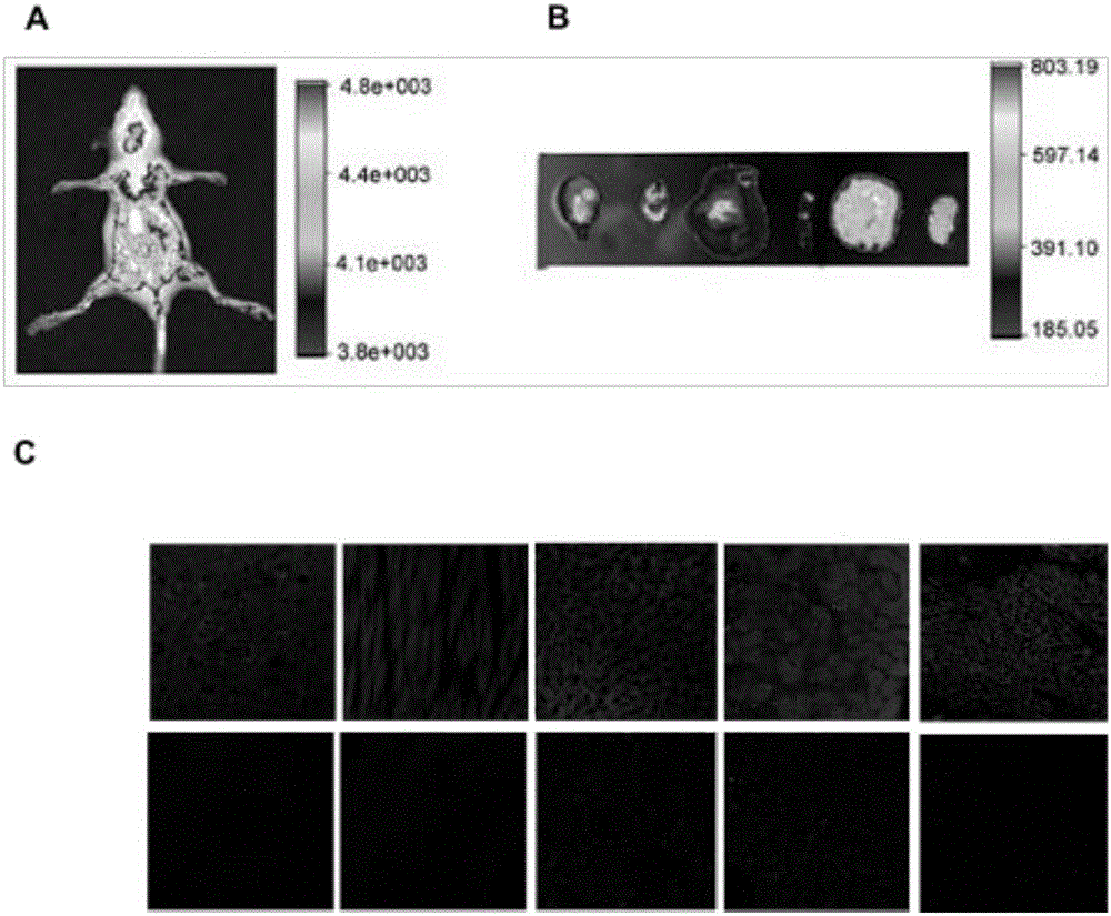 Mitochondria injection and application thereof