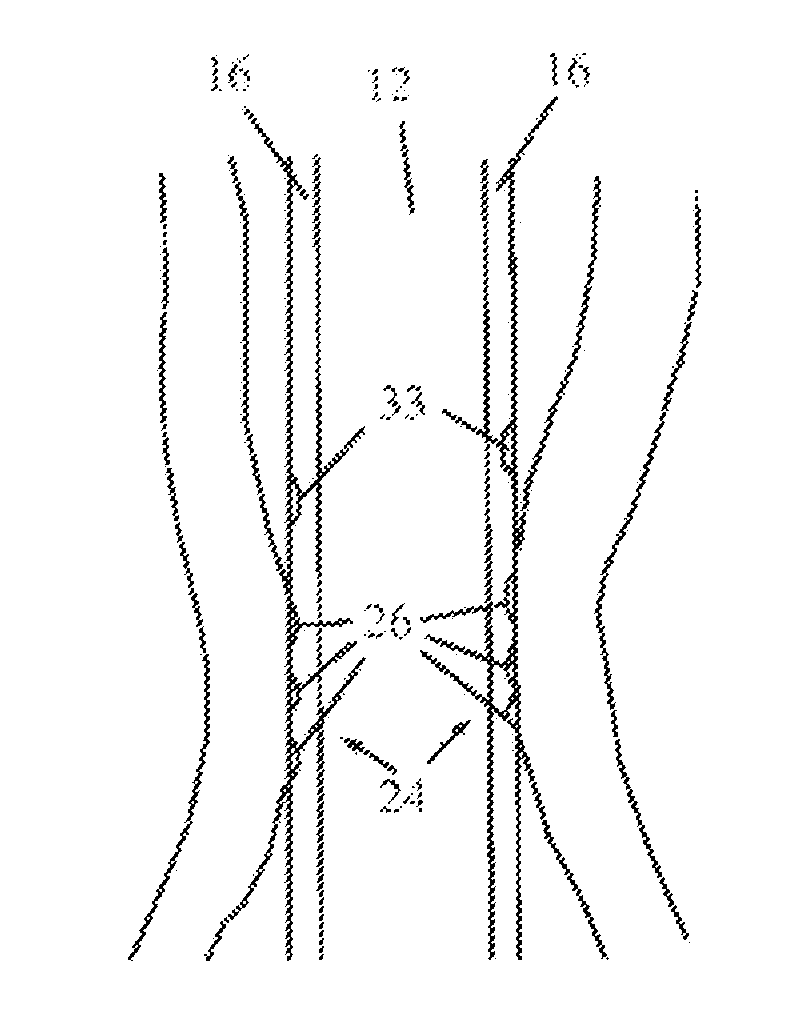 Nasogastric tube with camera