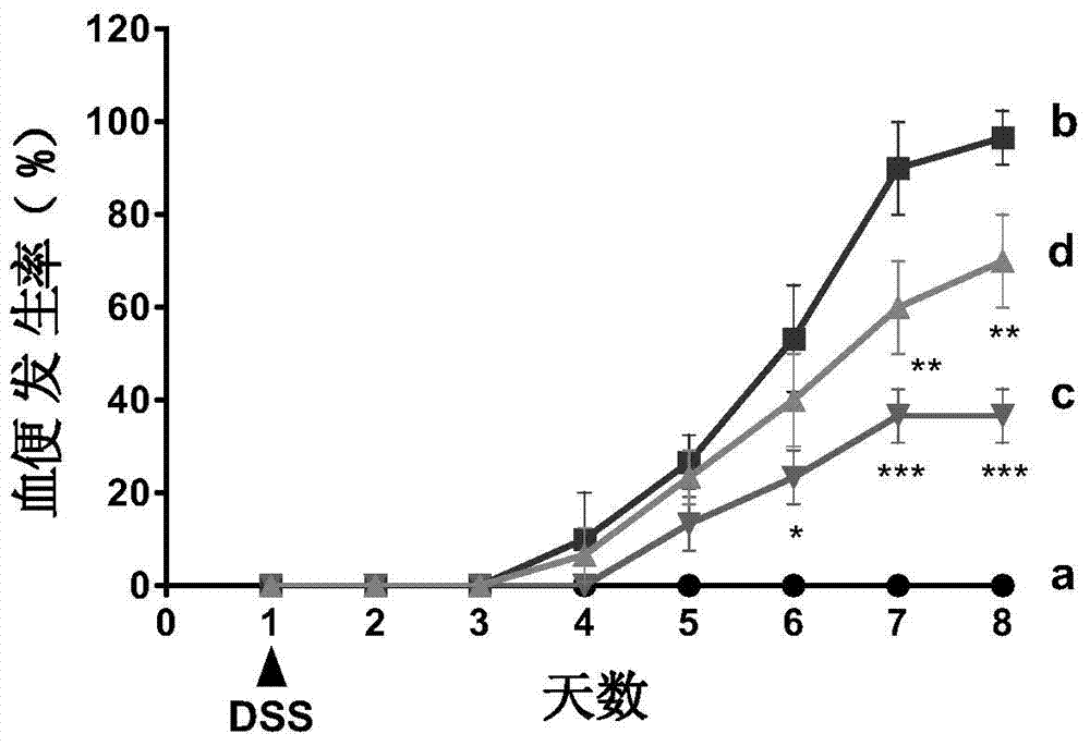 Use of notoginsenoside Ft1