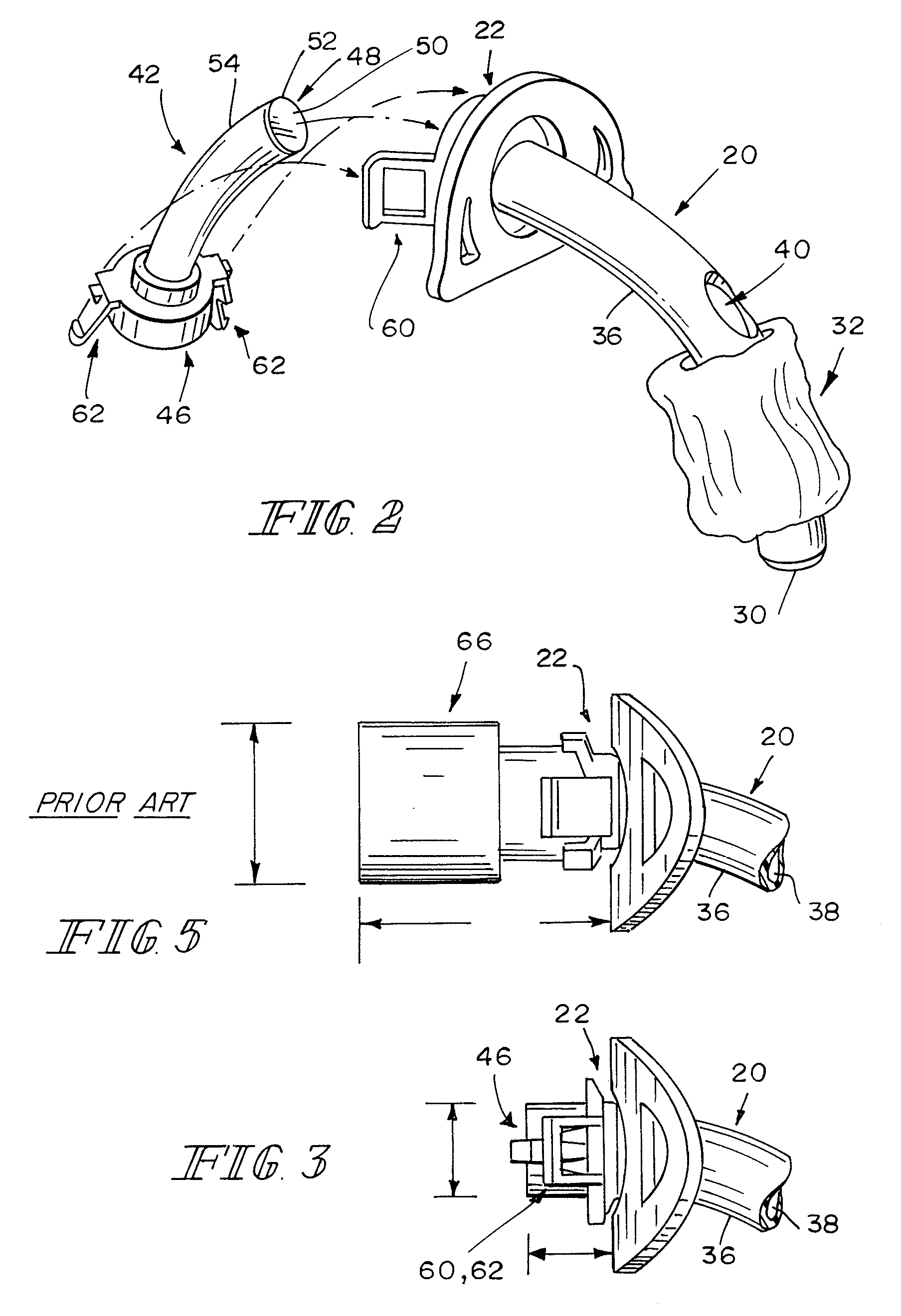 Speaking valve