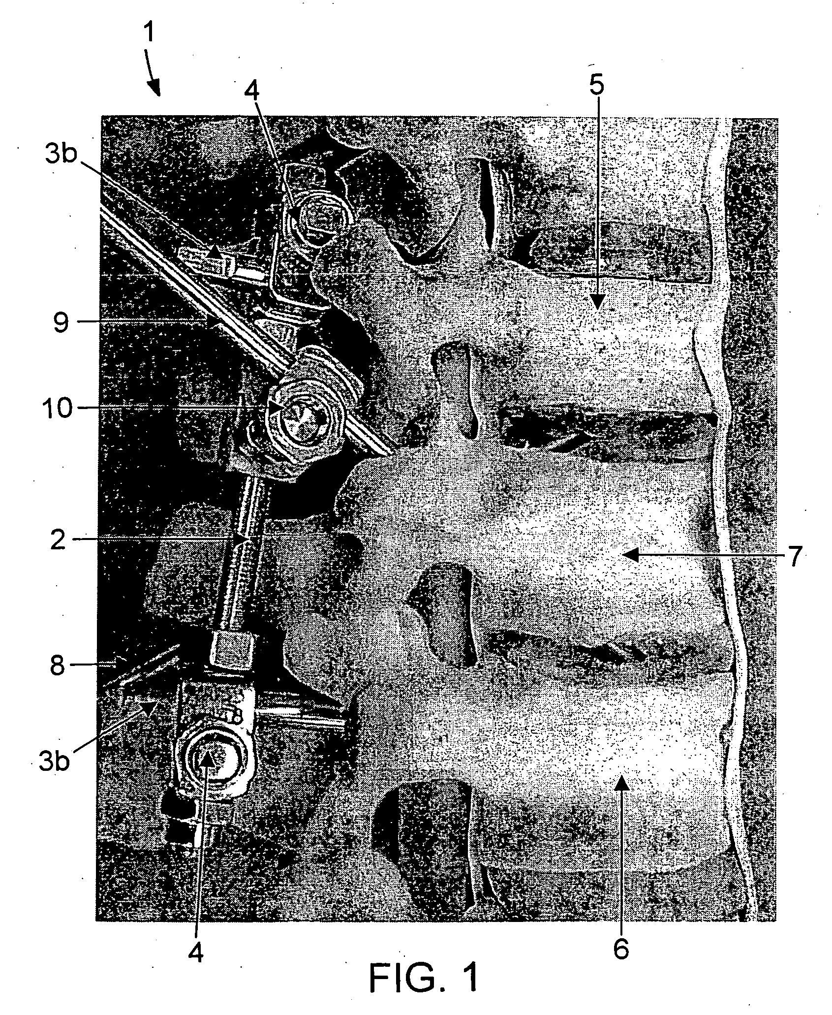 Spinal fixation support device and methods of using