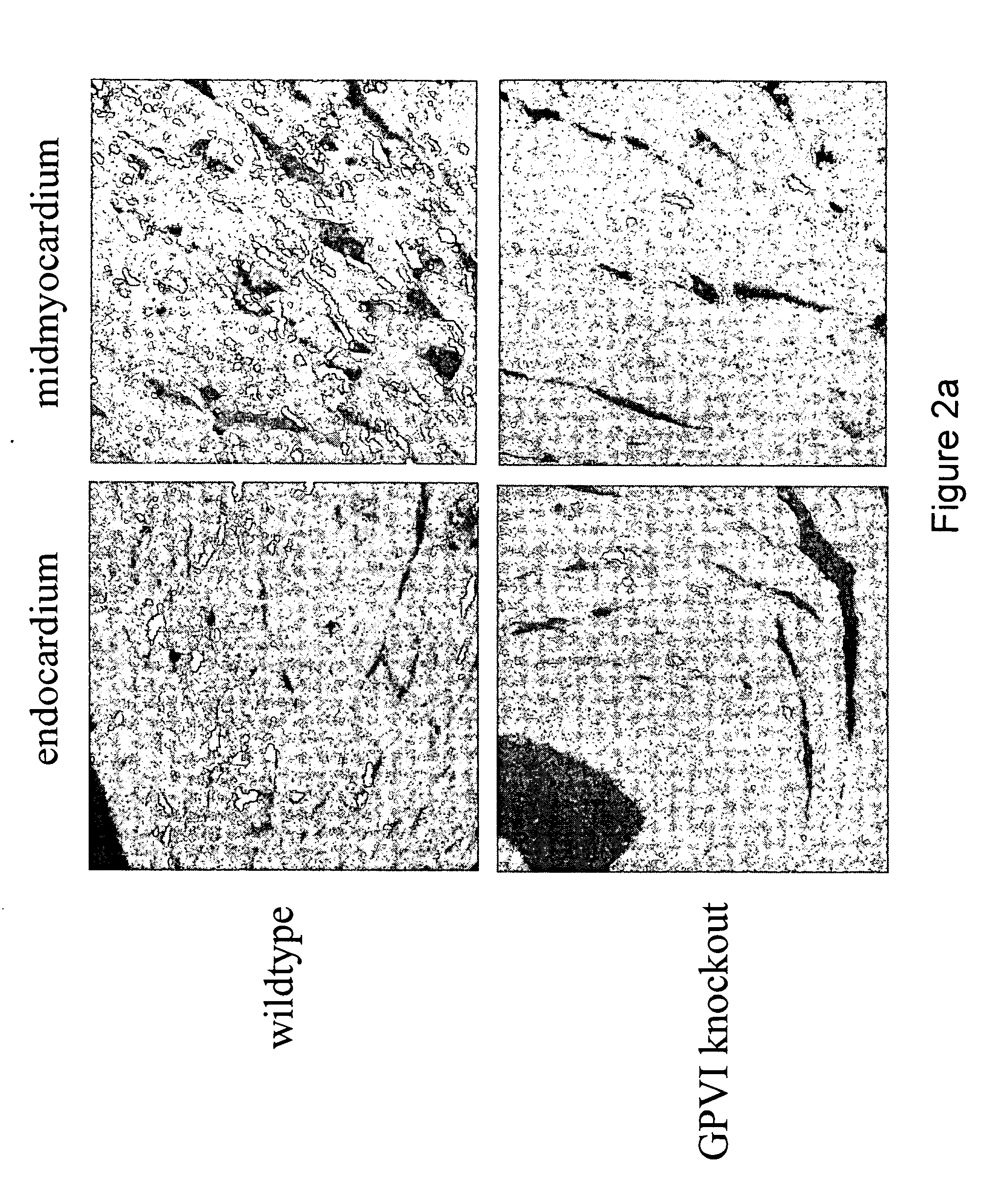 Uses of a glycoprotein vi (GPVI) inhibitor