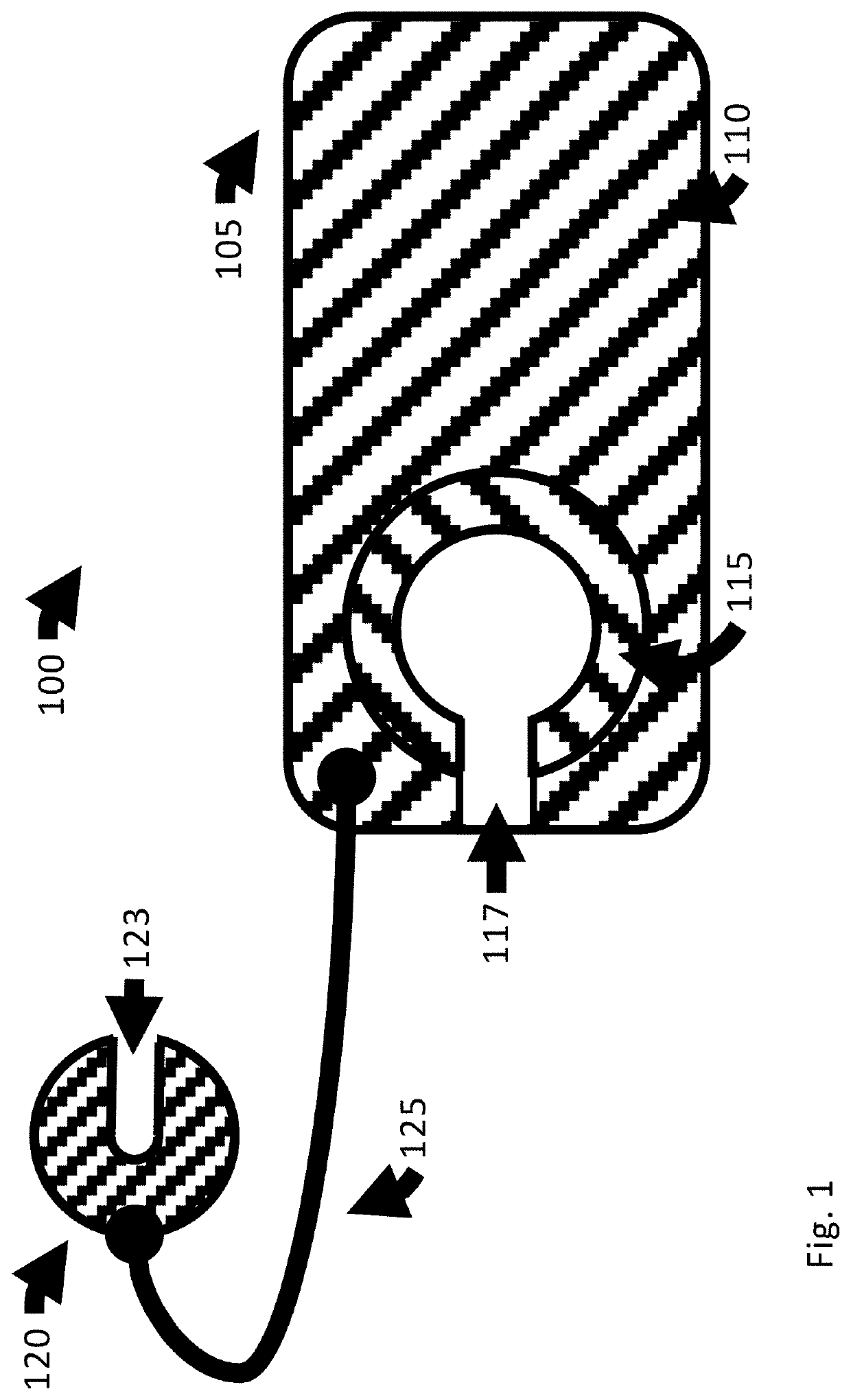 Catheter anchor system and method thereof