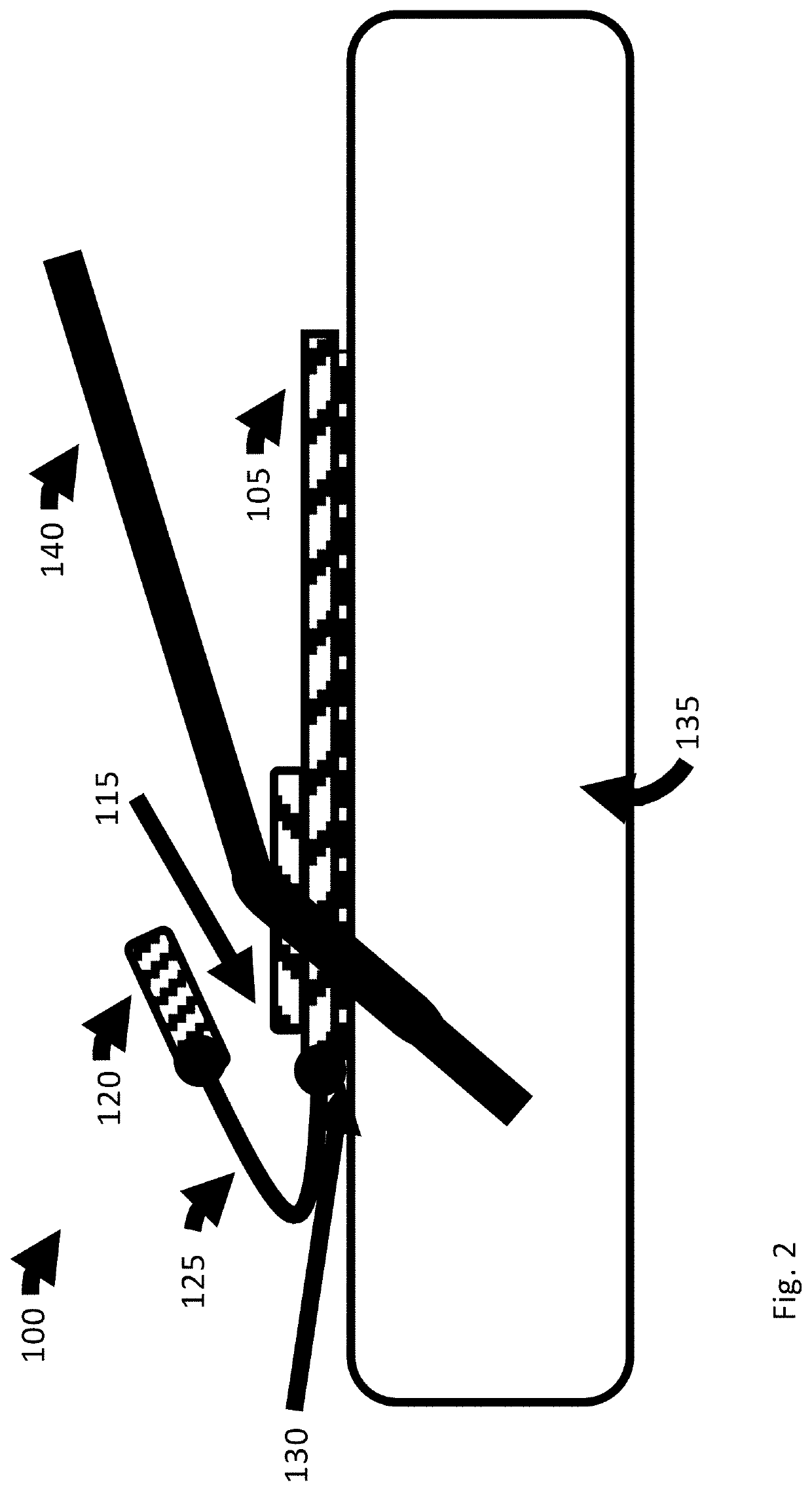 Catheter anchor system and method thereof