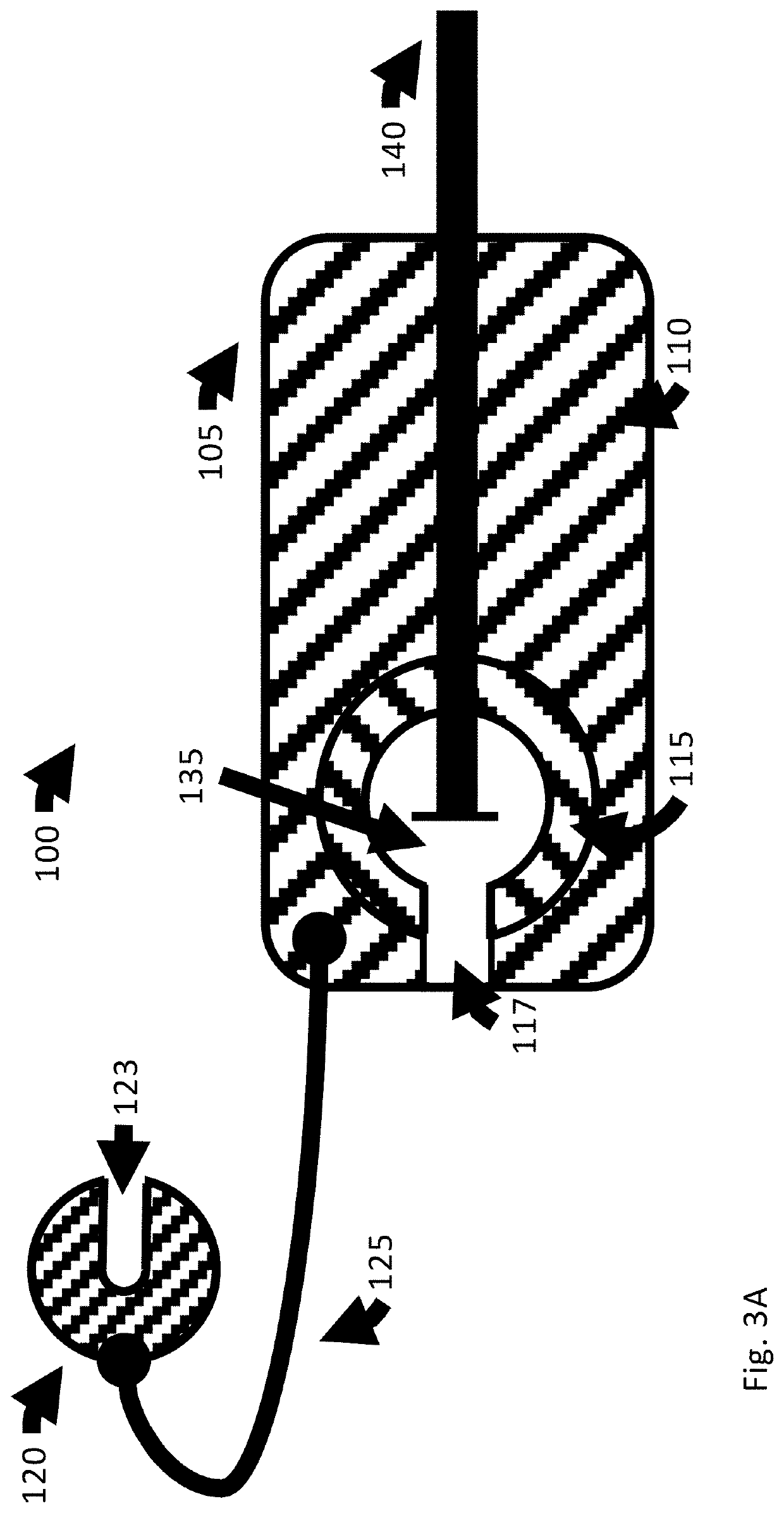 Catheter anchor system and method thereof