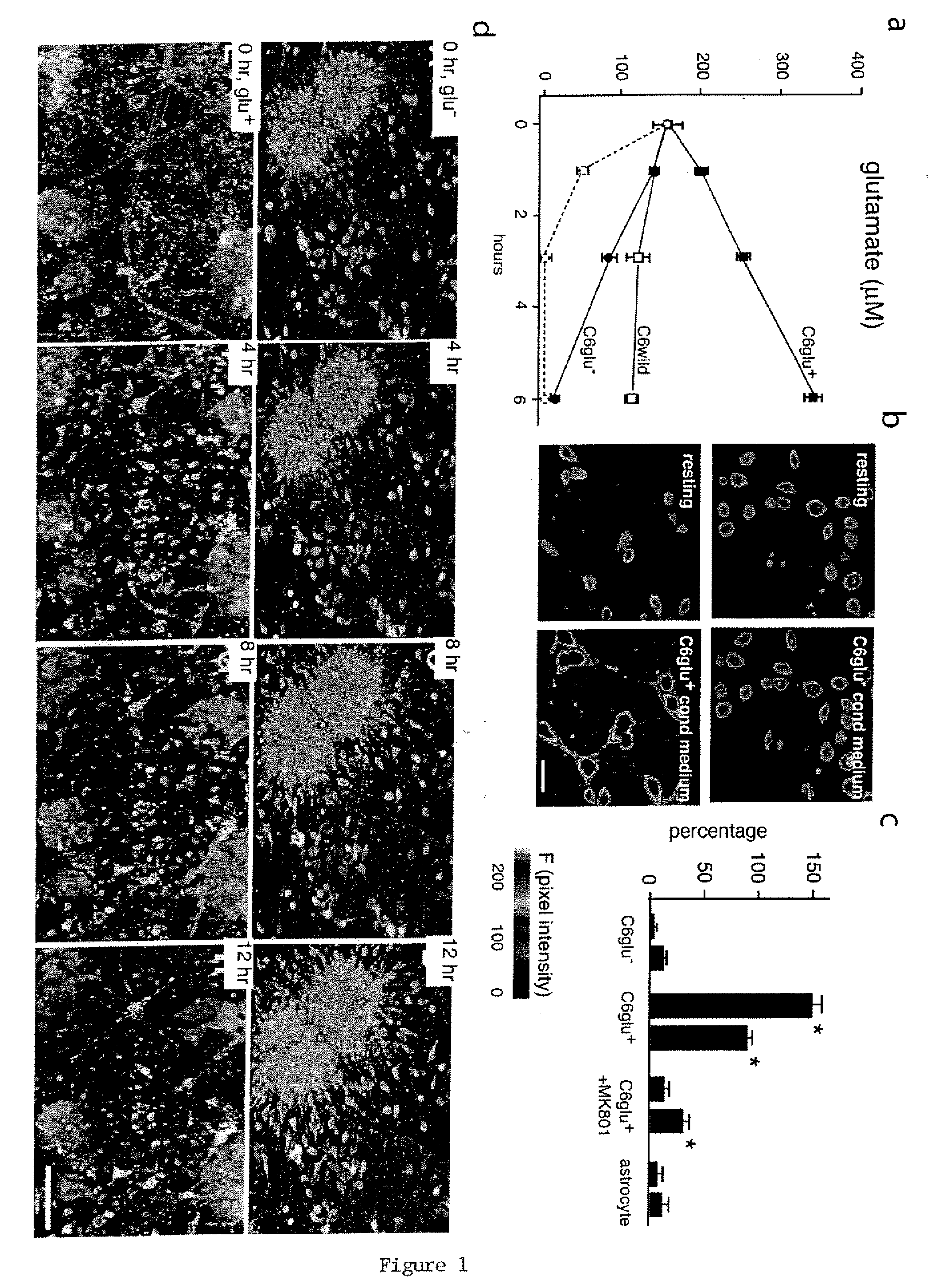 Treatment of glial tumors with glutamate antagonists