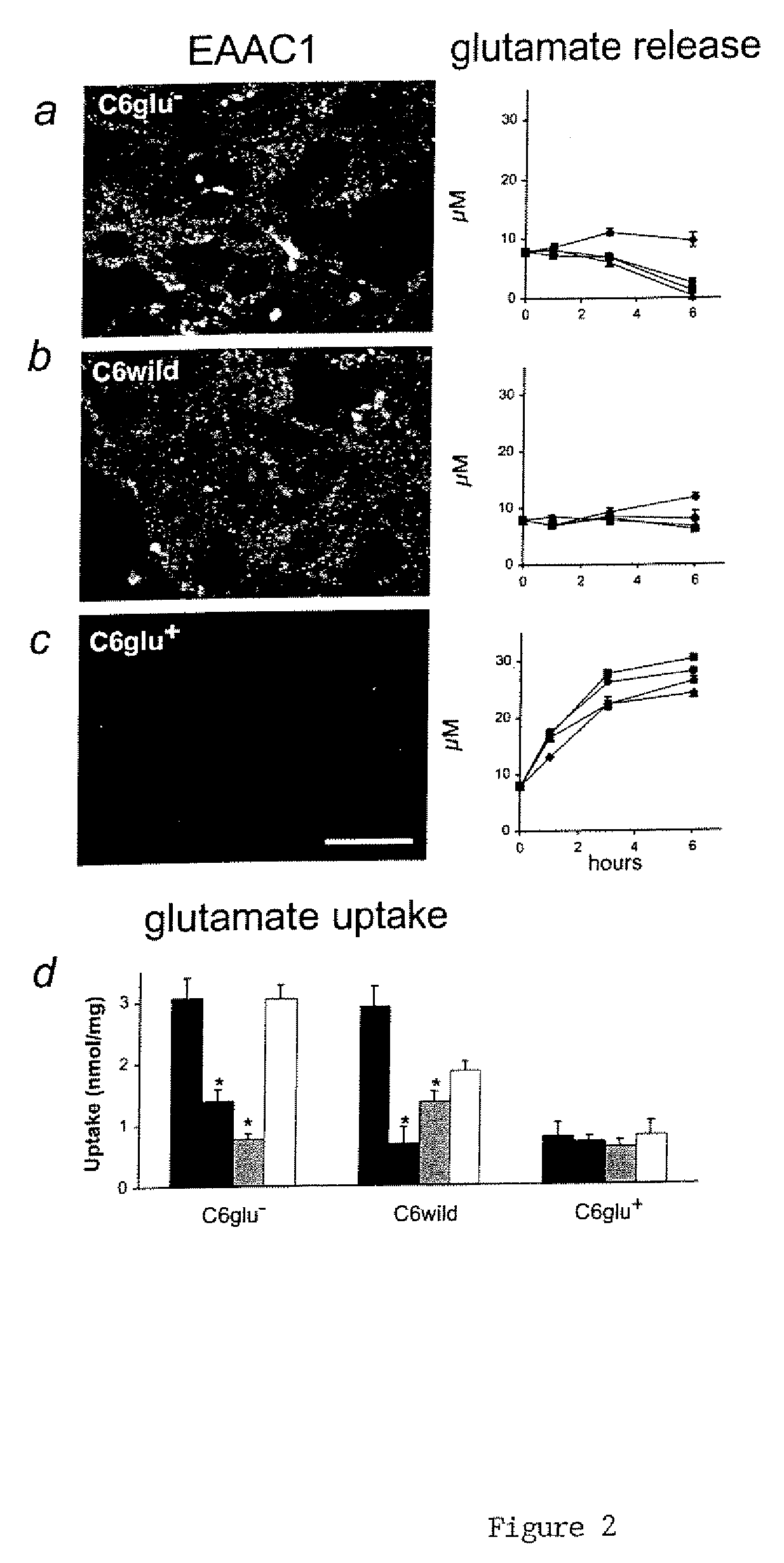 Treatment of glial tumors with glutamate antagonists