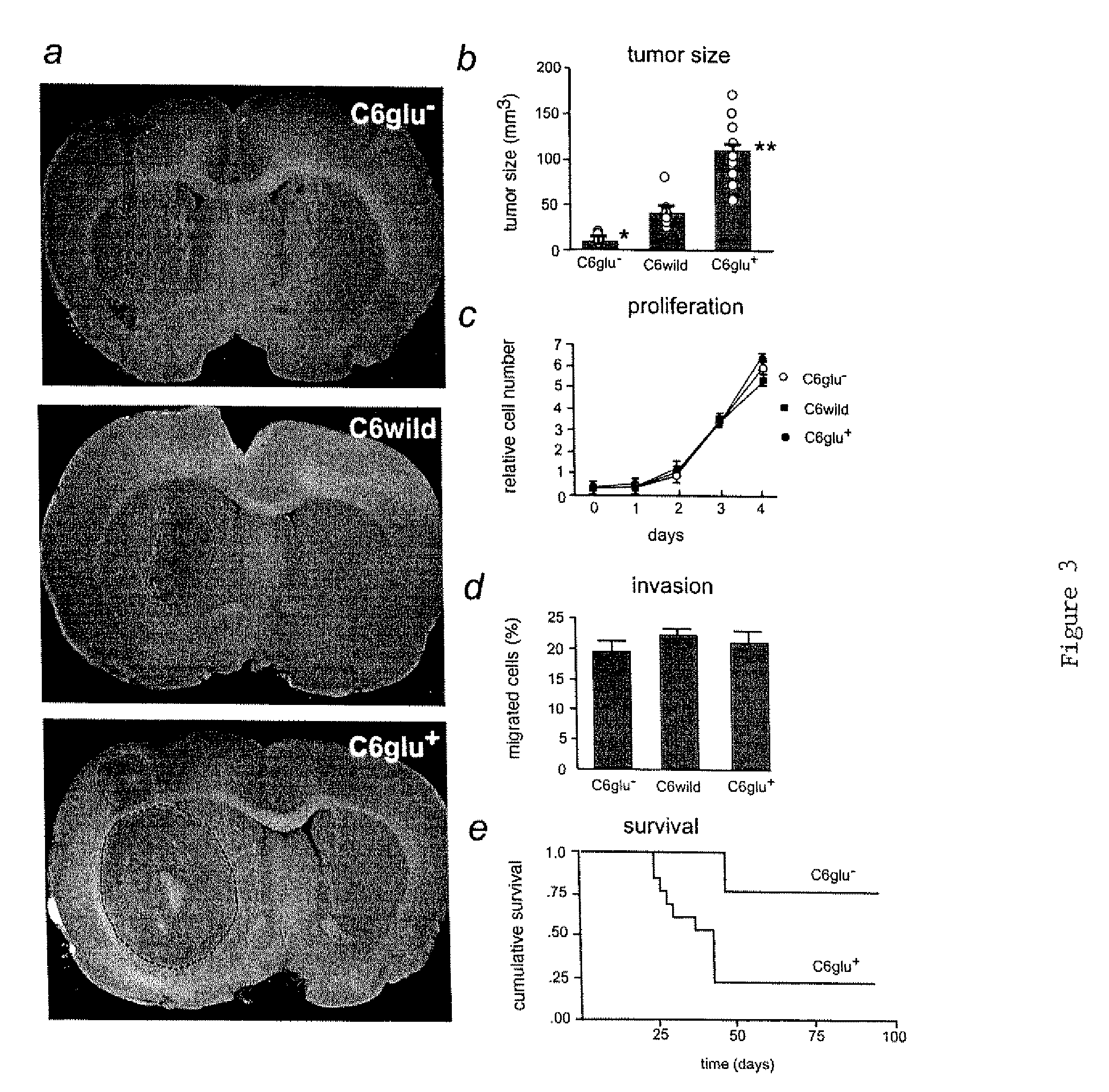 Treatment of glial tumors with glutamate antagonists