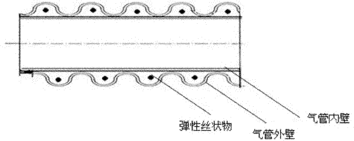 Woven artificial trachea and preparation method thereof