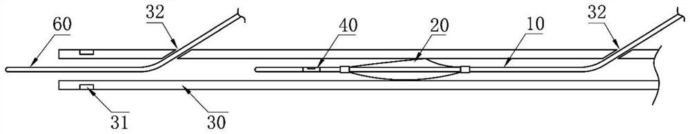 Embolic protection device