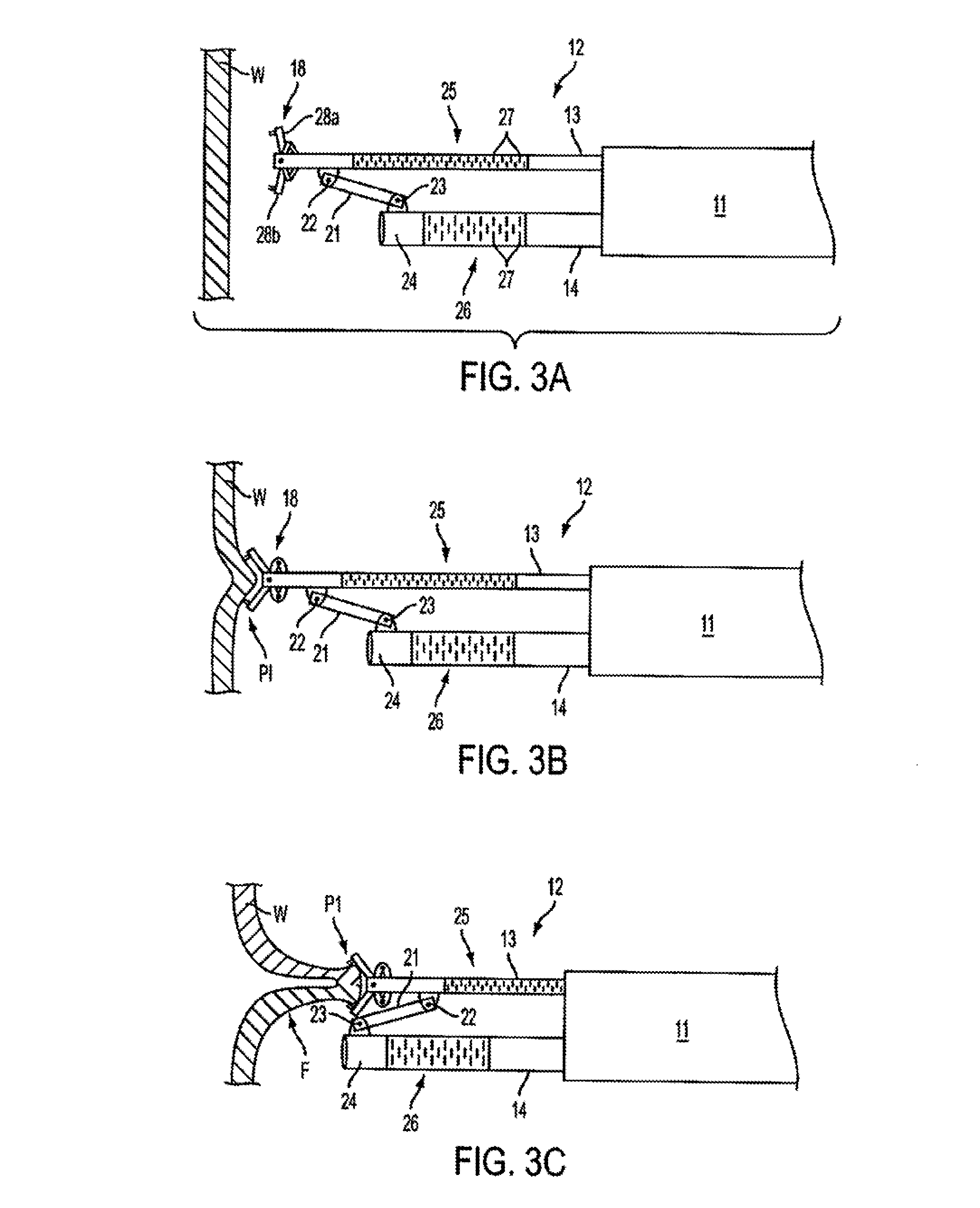 Apparatus and methods for forming and securing gastrointestinal tissue folds