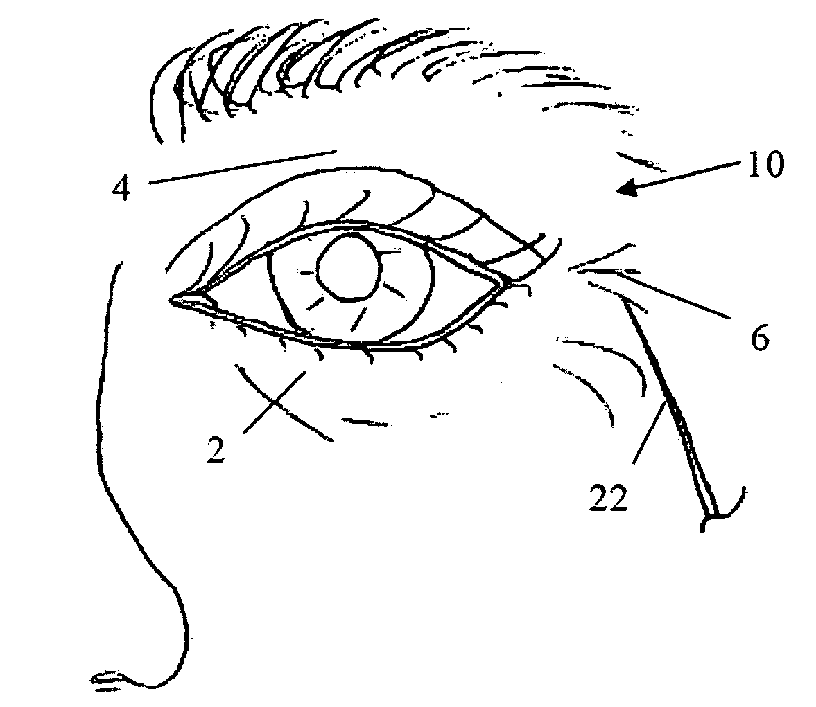 Device and methods for treatment of tissue