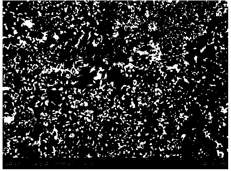 Preparation method of hydroxyapatite material doped with fluorine and potassium