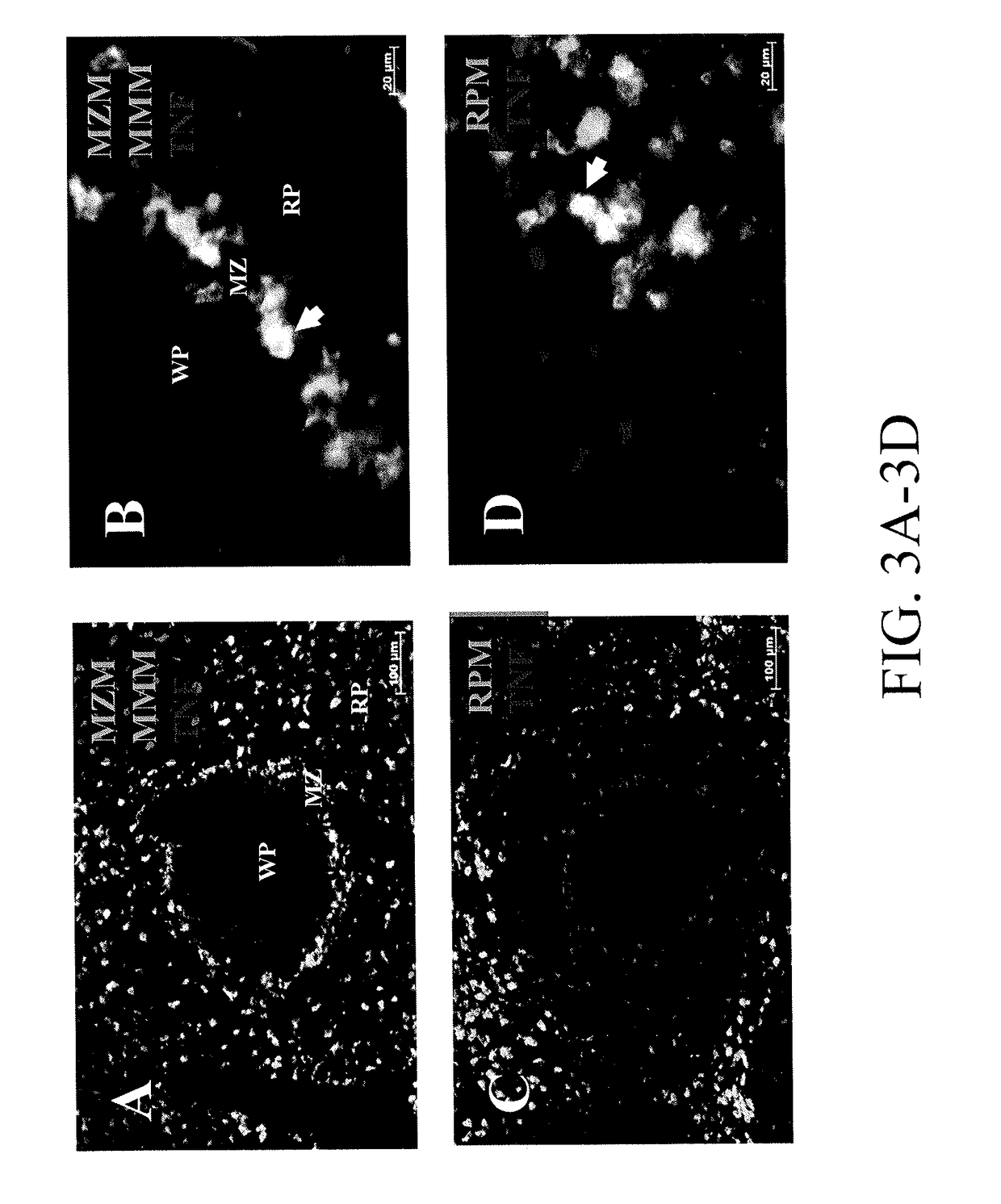 Methods and systems for reducing inflammation by neuromodulation and administration of an anti-inflammatory drug