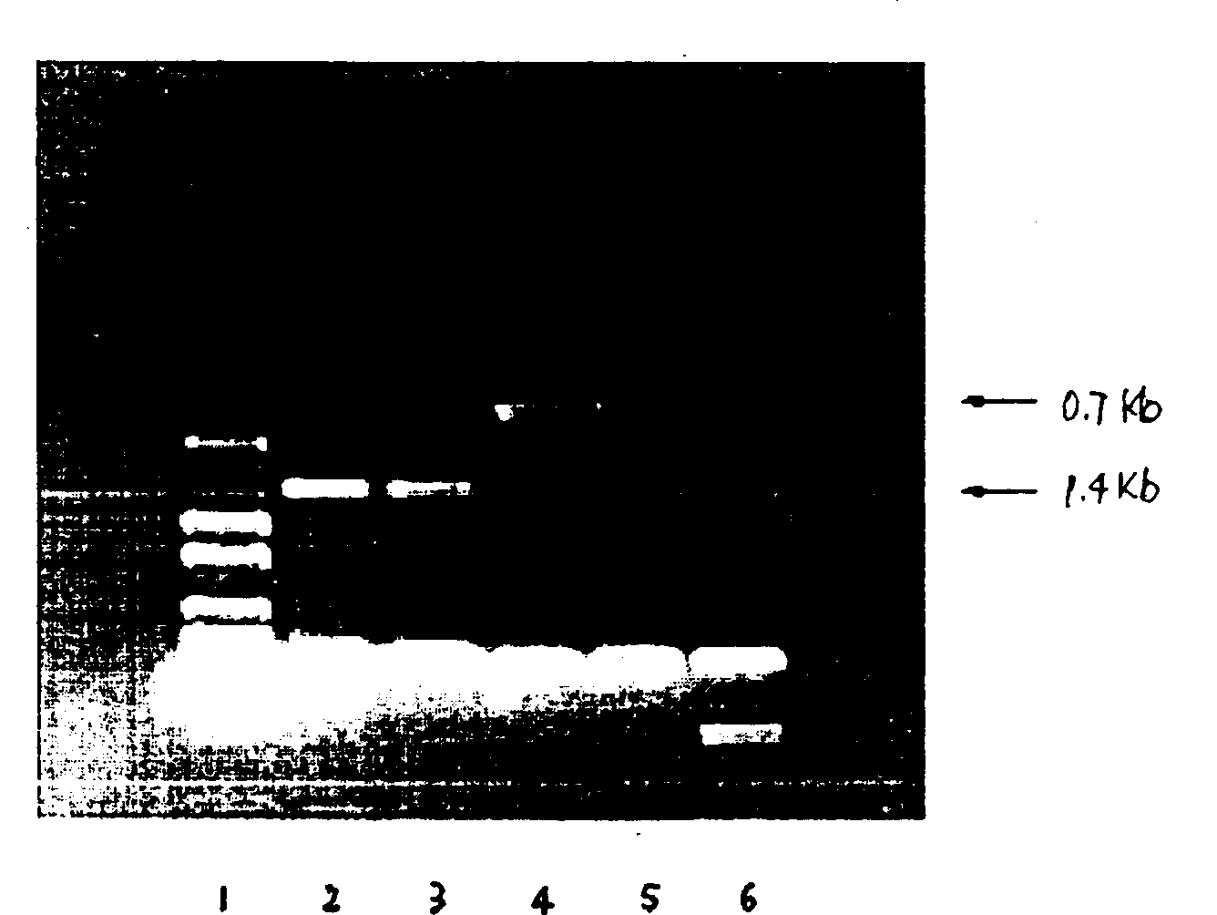 Preparation and application of humanized anti-spasmotoxin monoclone antibody