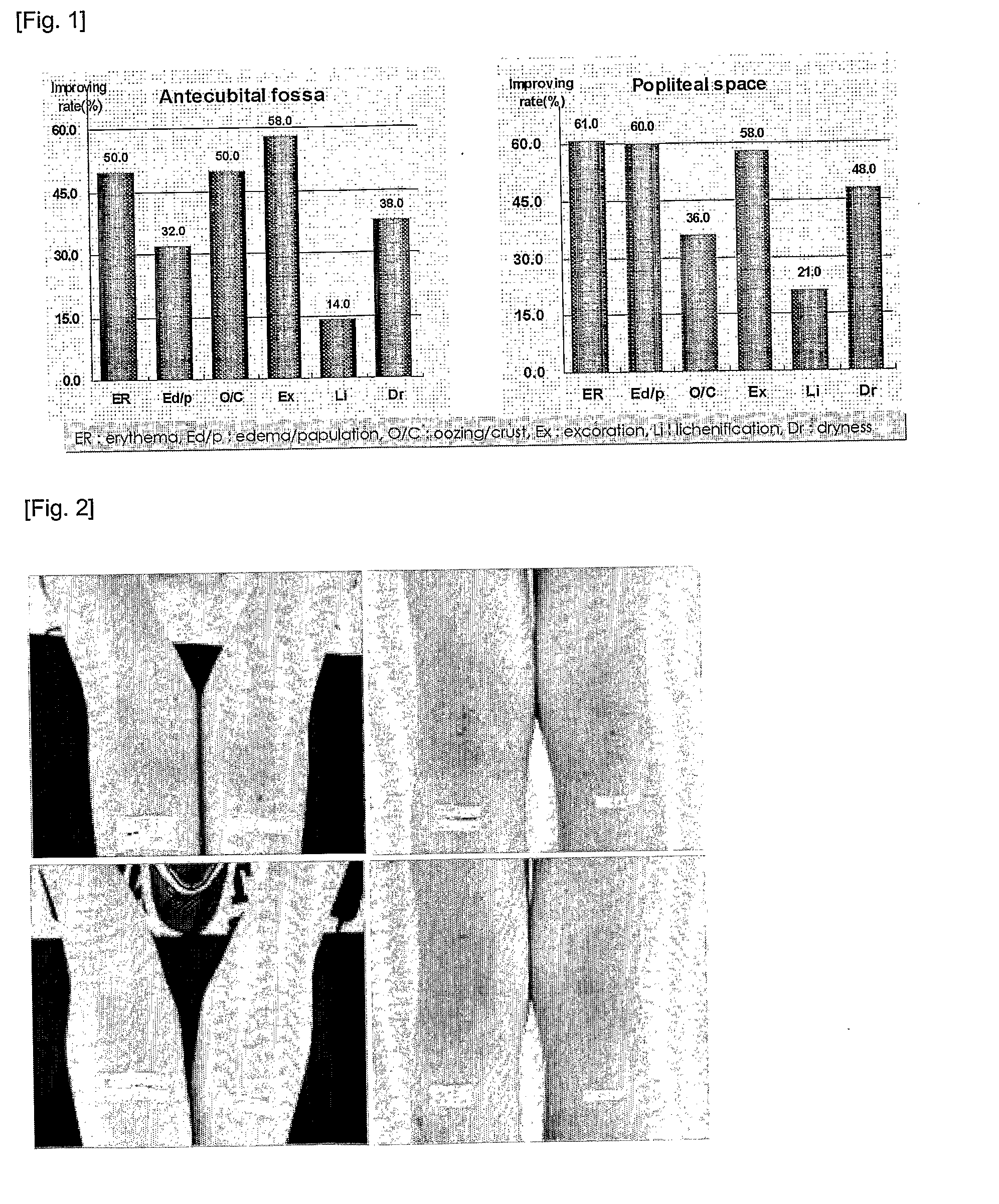 Composition For Treating Atopic Dermatitis Comprising Extracts Of Bamboo And Scutellaria