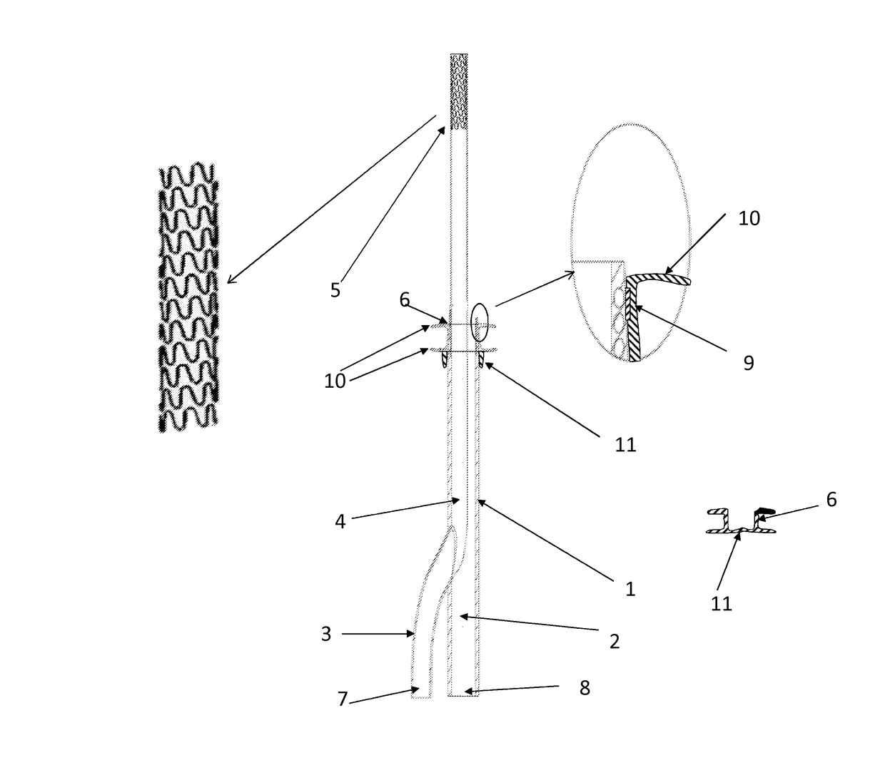 Self-sealing cannula