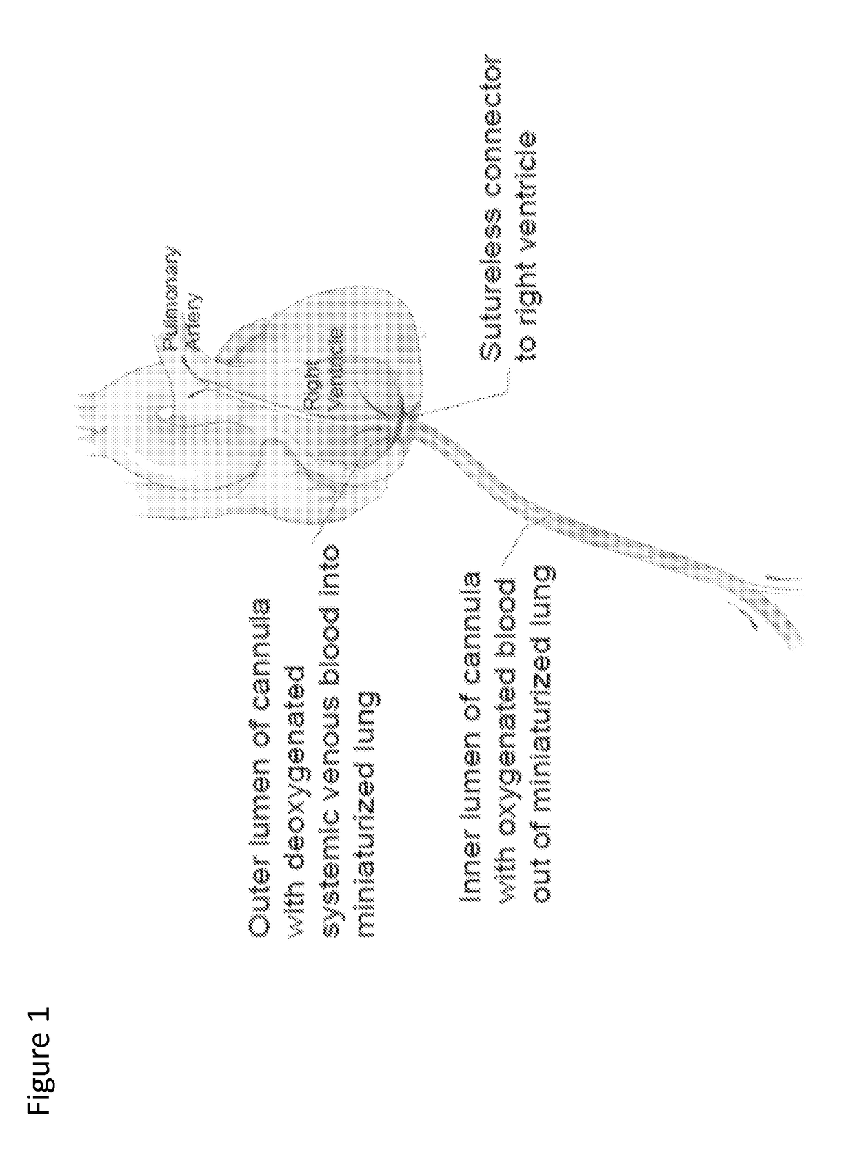 Self-sealing cannula