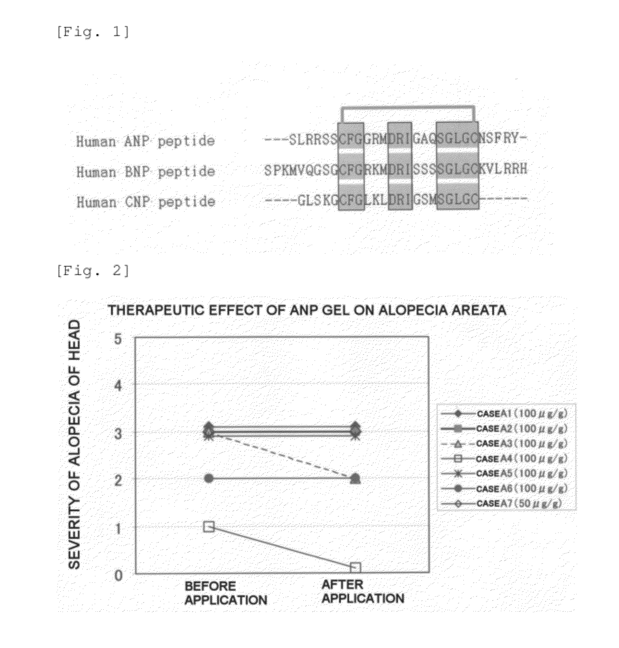 Agent for the treatment of alopecia