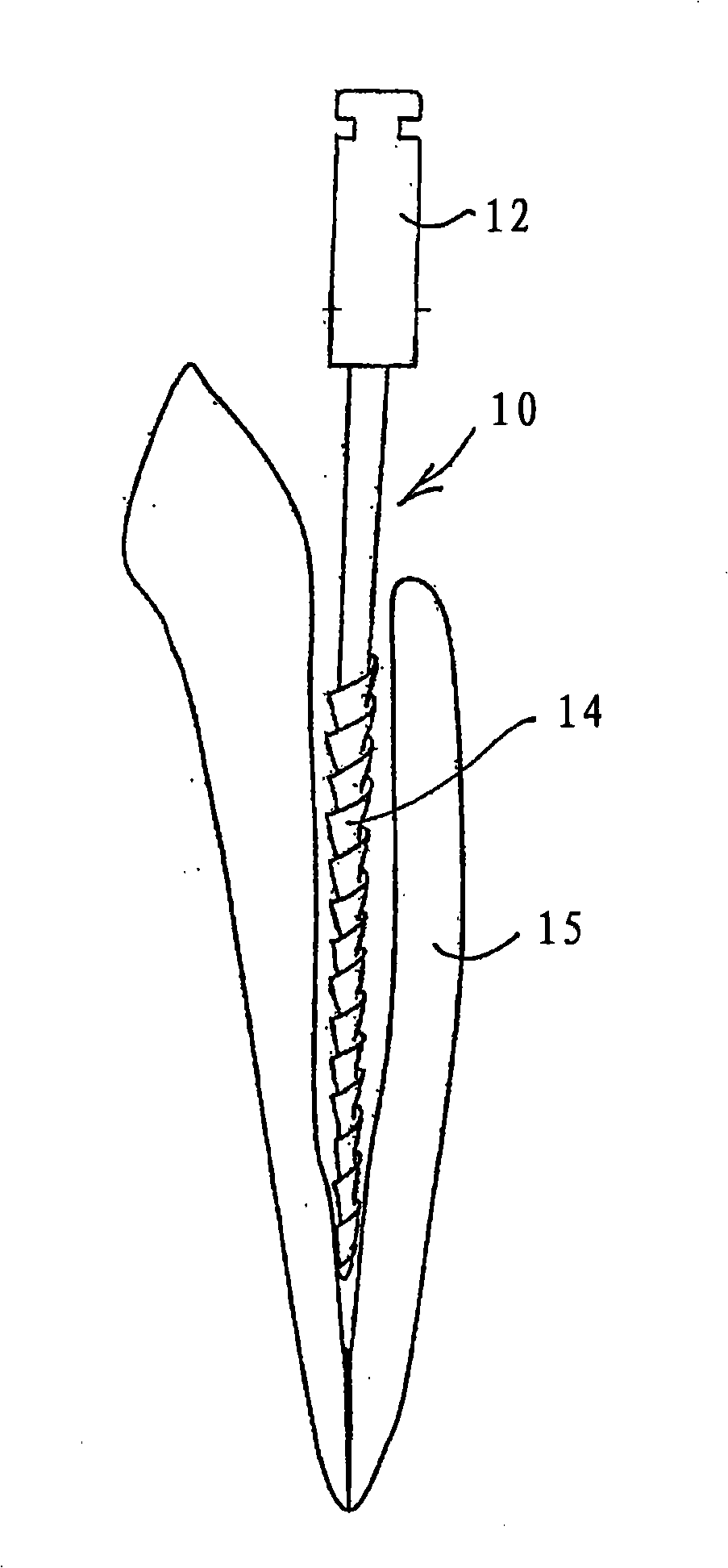 Dental apparatus for shaping and cleaning a root canal