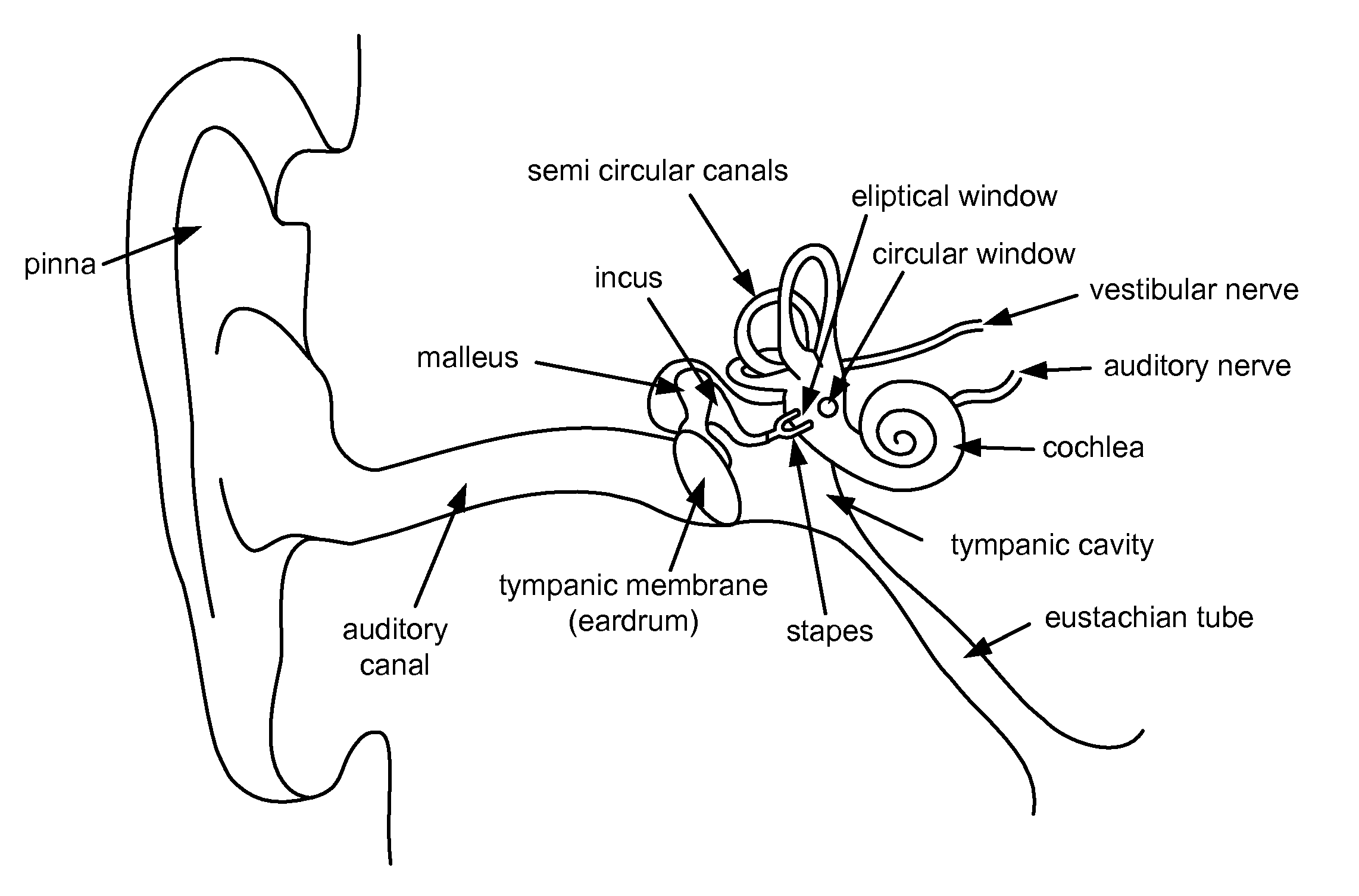 Controlled release delivery devices for the treatment of otic disorders