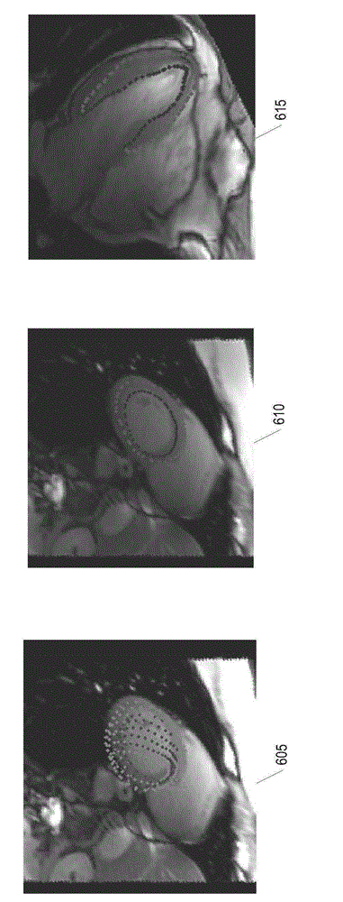 Methods and systems for automatically determining magnetic field inversion time of a tissue species