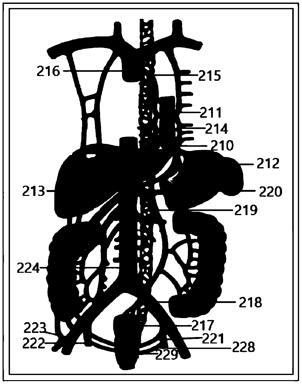 Hepatic portal vein blood backflow demonstration device