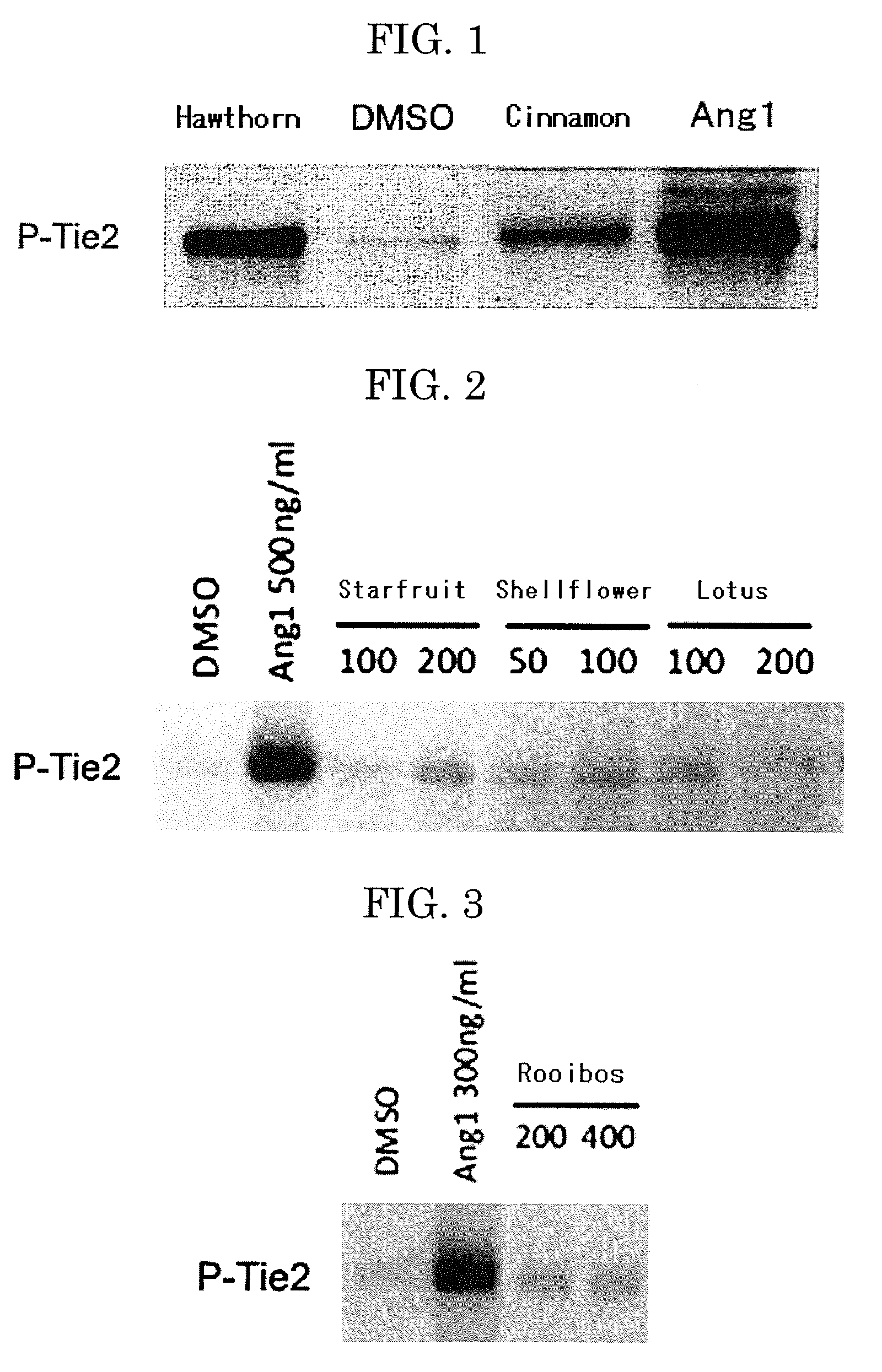 TIE2 Activator, Vascular Endothelial Growth Factor (VEGF) Inhibitor, Angiogenesis Inhibitor, Vascular Maturing Agent, Vascular Normalizing Agent and Vascular Stabilizing Agent, and Pharmaceutical Composition