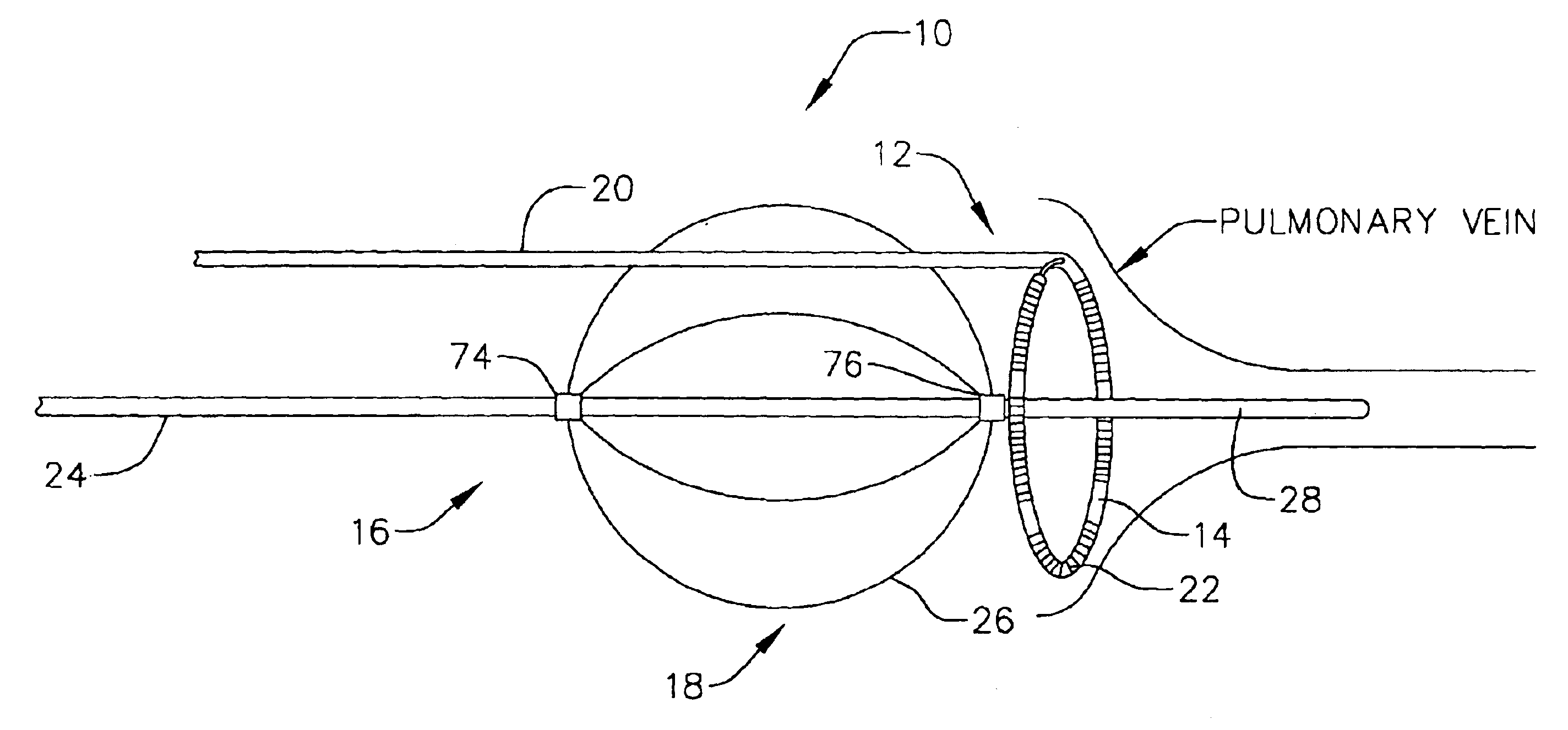 Loop structures for supporting diagnostic and therapeutic elements in contact with body tissue and expandable push devices for use with same