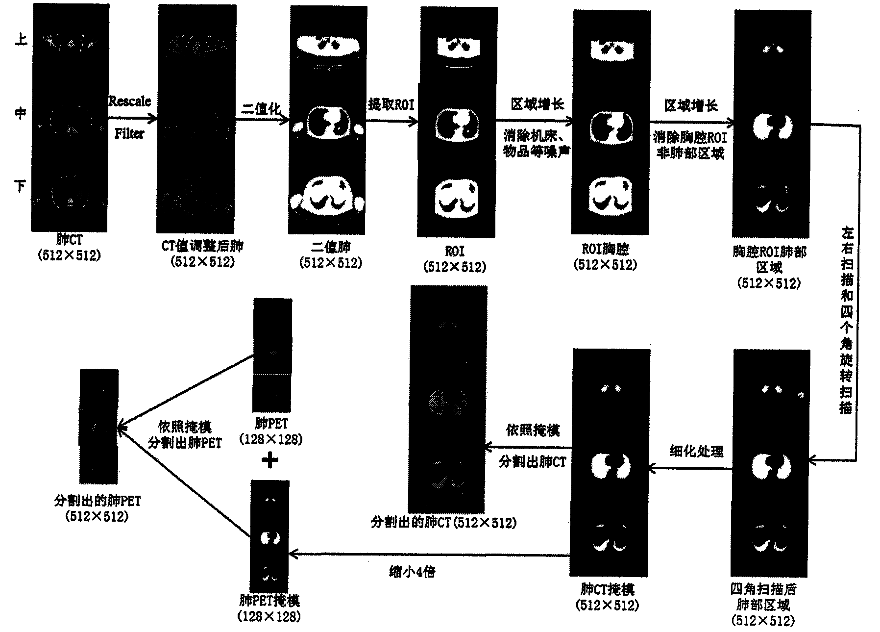 Method for segmenting and denoising lung parenchyma through lateral scanning and four-corner rotary scanning