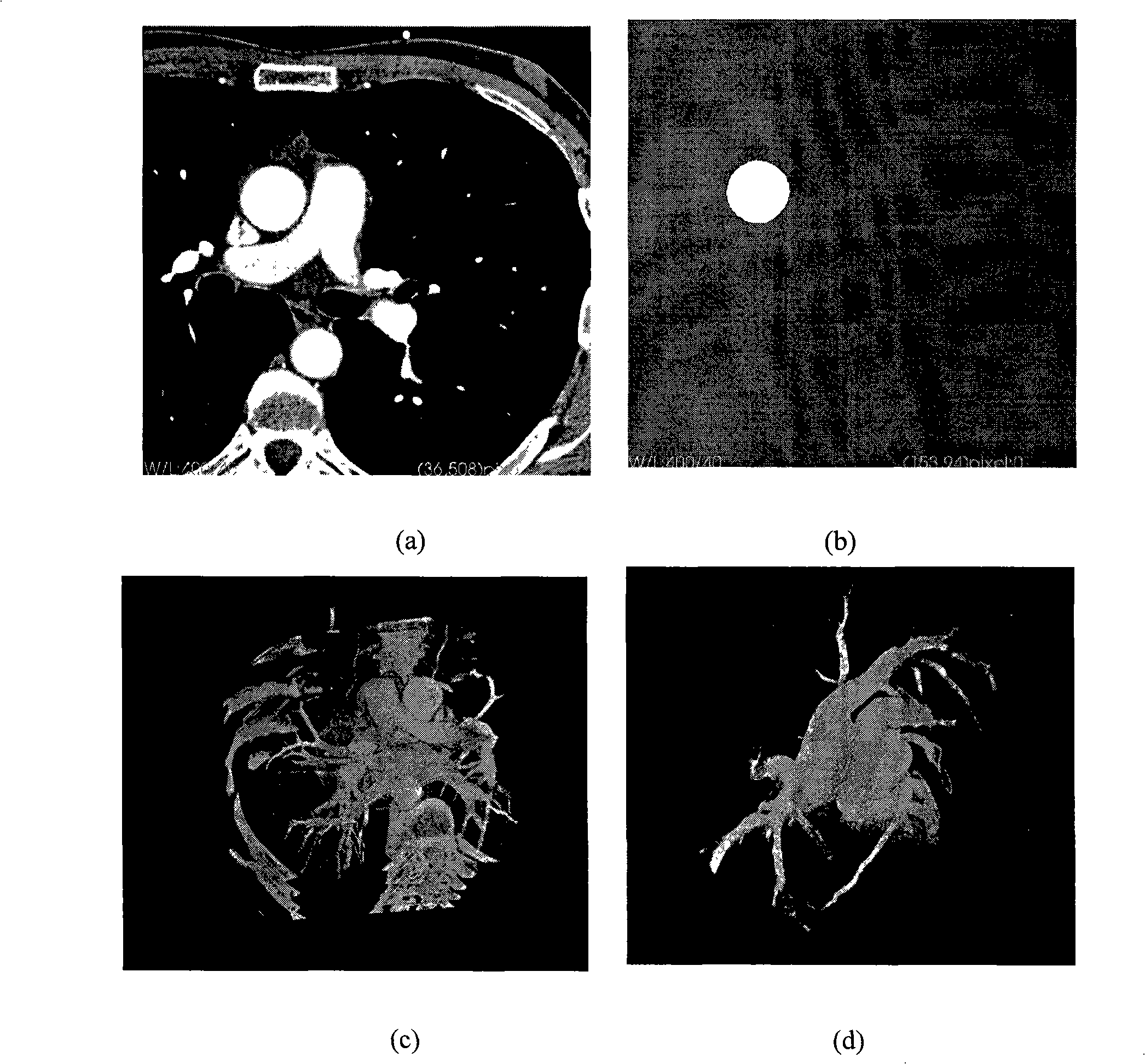 Simulated operation planning method based on medical image