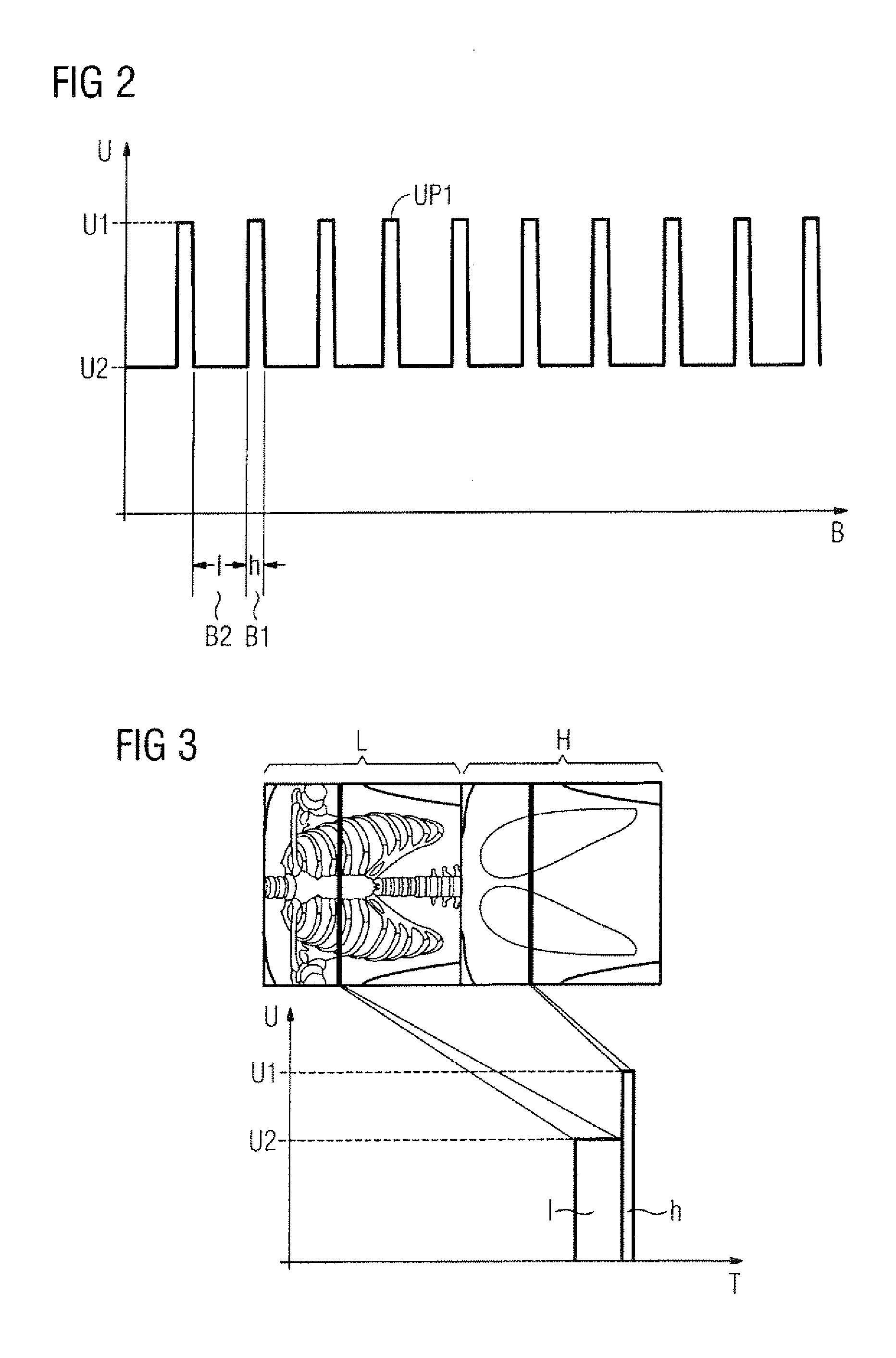 X-ray tomography apparatus and operating method for generating multiple energy images