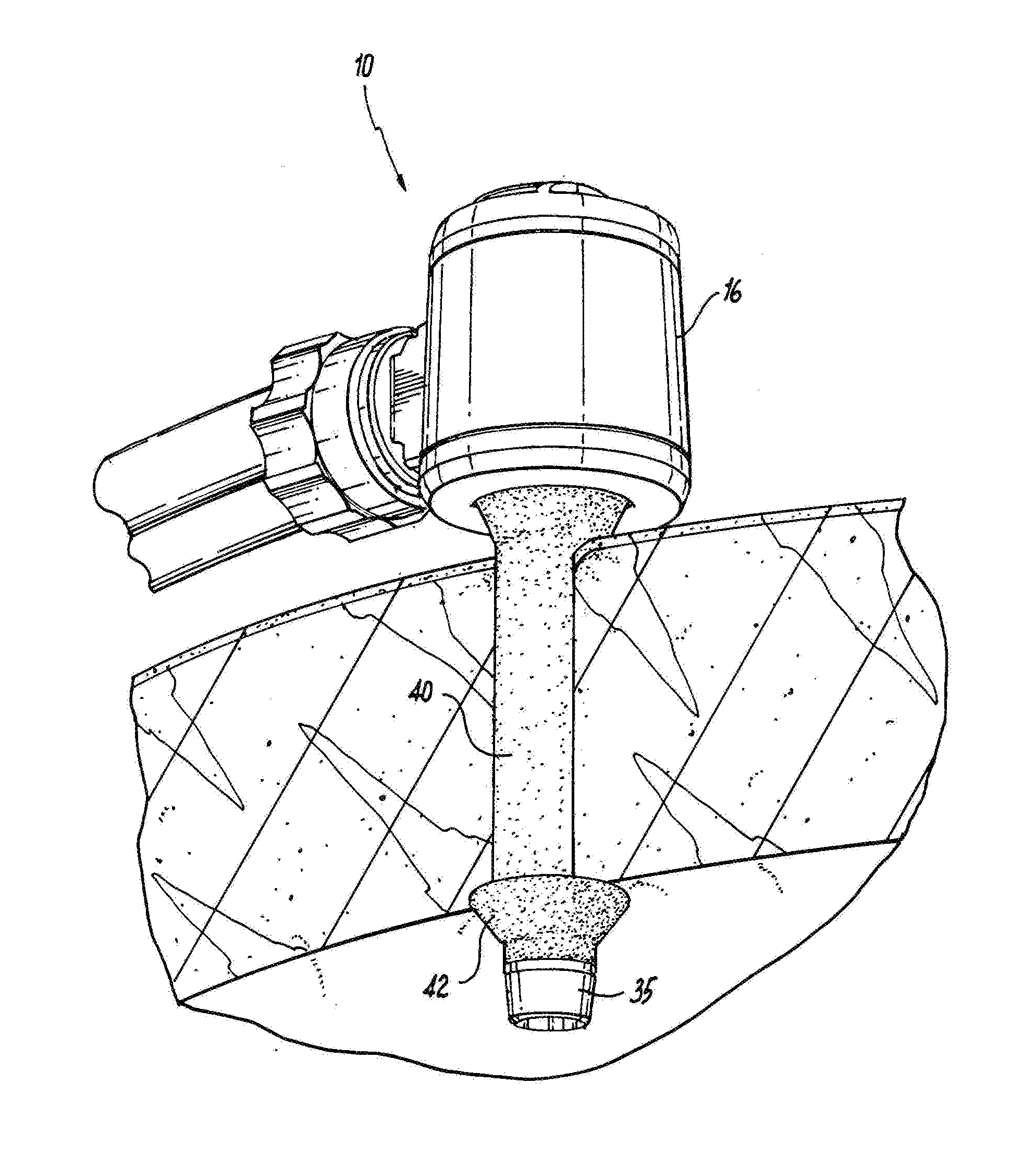 Self-adjusting pneumatically sealed trocar