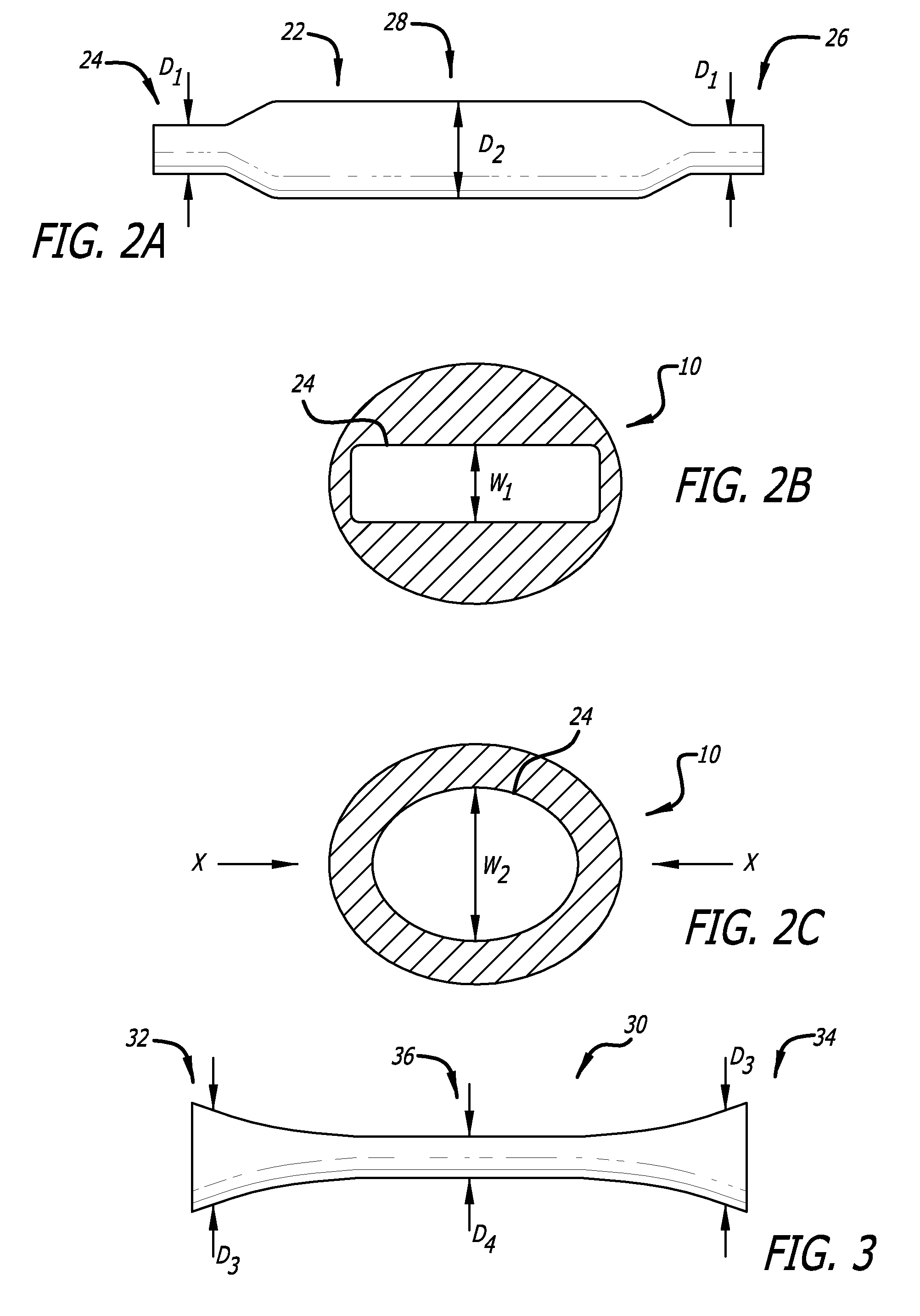 Sheaths for extra-articular implantable systems