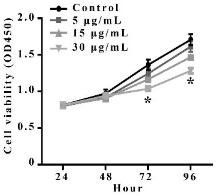 Fungal immunomodulatory protein derived from Morchella conica and application thereof