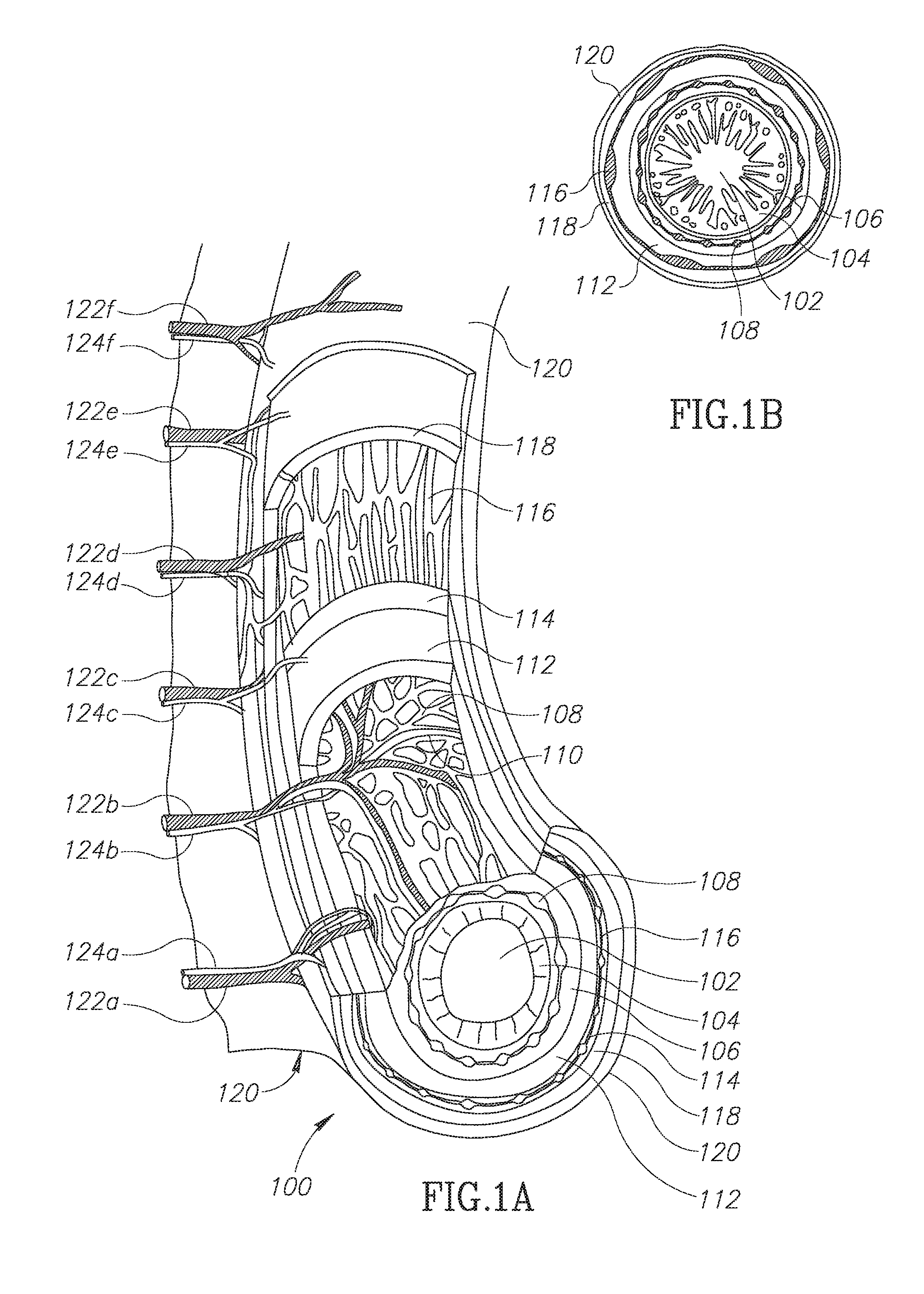 Methods and systems for reducing neural activity in an organ of a subject