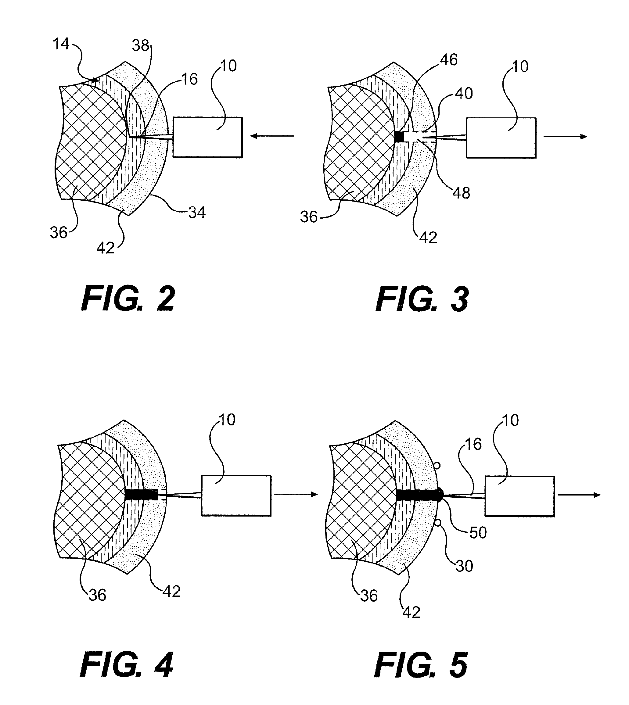 Method and device for the extraction of a body fluid