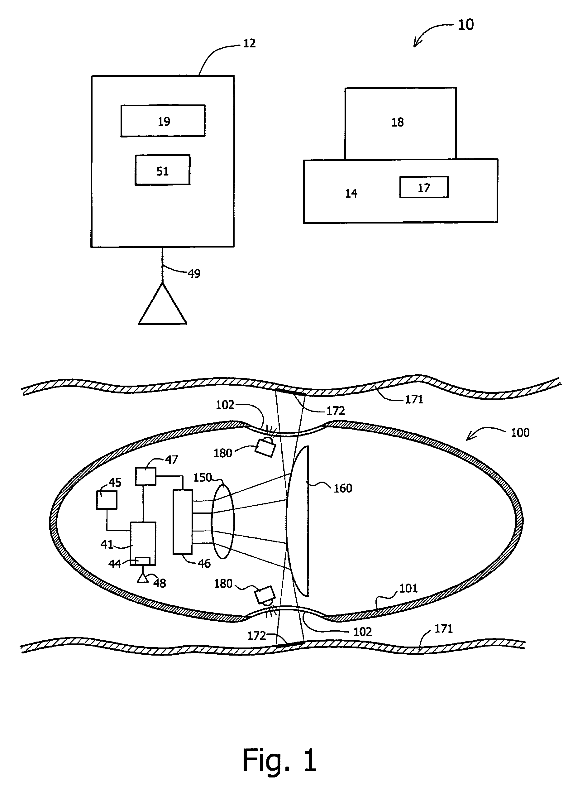 Device, system, and method for reducing image data captured in-vivo