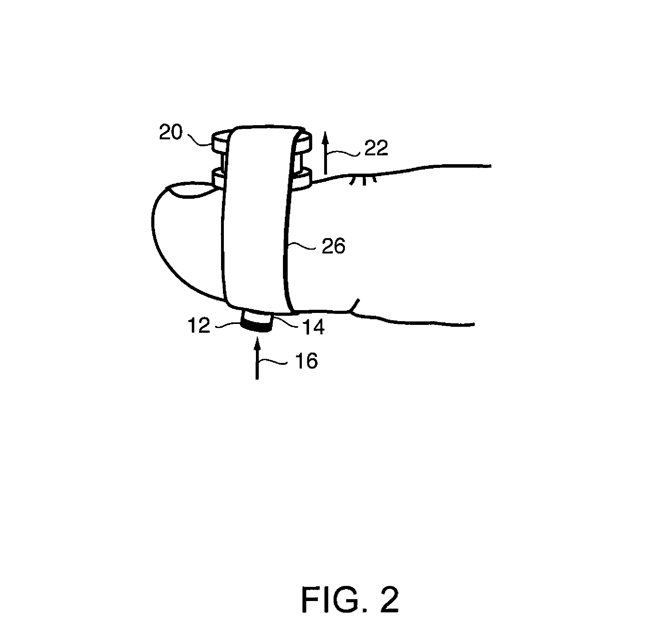 Portable haptic force magnifier