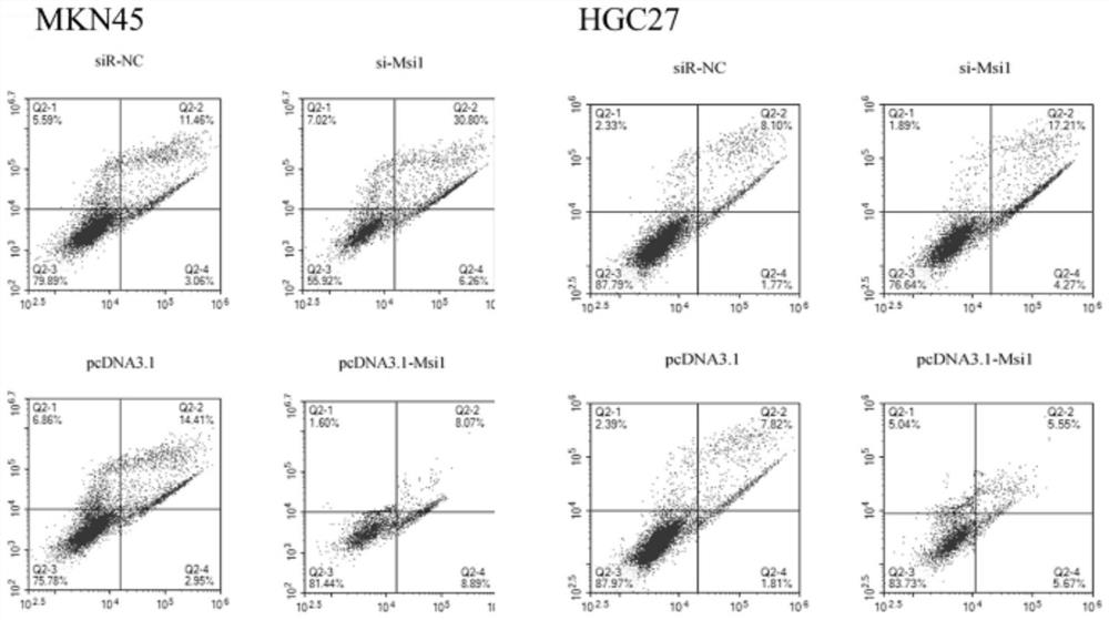 Application of Msi1 in preparation of gastric cancer treating preparation and prediction of tolerance of chemotherapy drug